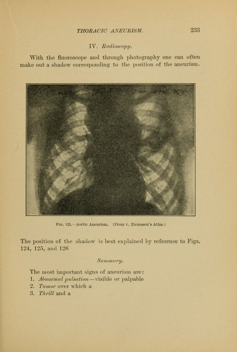 IV. Radioscopy. With the fluoroscope and through photography one can often make out a shadow corresponding to the position of the aneurism. Fig. 125.—Aortic Aneurism. (From v. Ziemsseu's Atlas.) The position of the shadow is best explained by reference to Figs. 124, 125, and 126 Summitry. The most important signs of aneurism are: 1. Abnormal pulsation—visible or palpable 2. Tumor over which a 3. Thrill and a