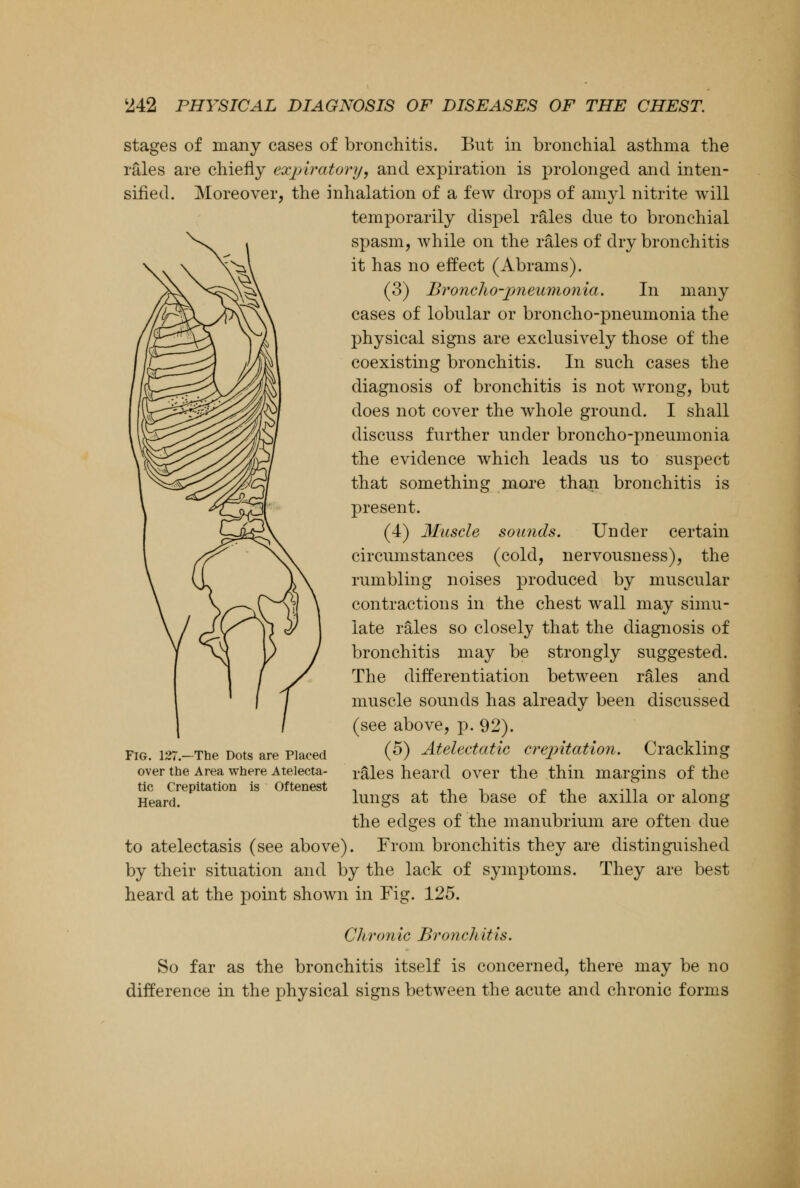 stages of many cases of bronchitis. But in bronchial asthma the rales are chiefly expiratory, and expiration is prolonged and inten- sified. Moreover, the inhalation of a few drops of amyl nitrite will temporarily dispel rales due to bronchial spasm, while on the rales of dry bronchitis it has no effect (Abrams). (3) Broncho-pneumonia. In many cases of lobular or broncho-pneumonia the physical signs are exclusively those of the coexisting bronchitis. In such cases the diagnosis of bronchitis is not wrong, but does not cover the whole ground. I shall discuss further under broncho-pneumonia the evidence which leads us to suspect that something more than bronchitis is present. (4) Muscle sounds. Under certain circumstances (cold, nervousness), the rumbling noises produced by muscular contractions in the chest wall may simu- late rales so closely that the diagnosis of bronchitis may be strongly suggested. The differentiation between rales and muscle sounds has already been discussed (see above, p. 92). (5) Atelectatic crepitation. Crackling rales heard over the thin margins of the lungs at the base of the axilla or along the edges of the manubrium are often due to atelectasis (see above). From bronchitis they are distinguished by their situation and by the lack of symptoms. They are best heard at the point shown in Fig. 125. Fig. 127.—The Dots are Placed over the Area where Atelecta- tic Crepitation is Oftenest Heard. Chronic Bronch it is. So far as the bronchitis itself is concerned, there may be no difference in the physical signs between the acute and chronic forms