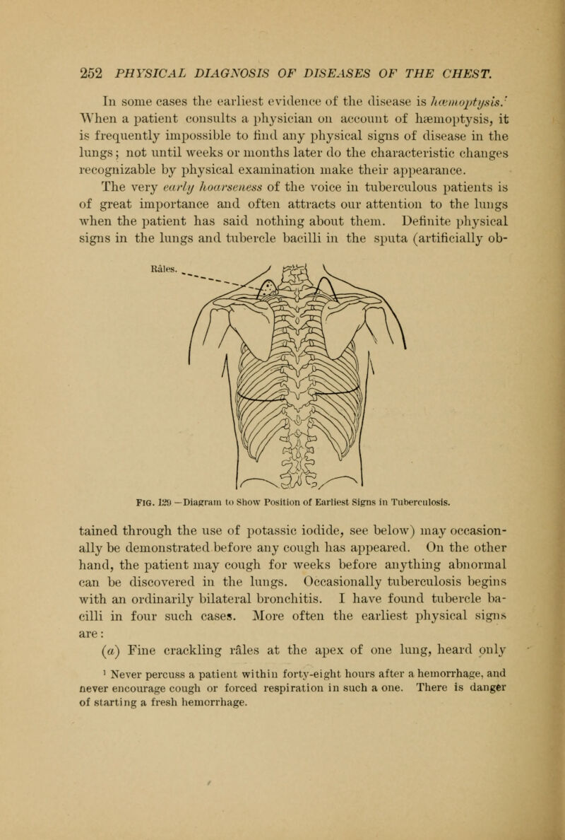 In some cases the earliest evidence of the disease is haemoptysis J When a patient consults a physician on account of haemoptysis, it is frequently impossible to find any physical signs of disease in the lungs; not until weeks or months later do the characteristic changes recognizable by physical examination make their appearance. The very early hoarseness of the voice in tuberculous patients is of great importance and often attracts our attention to the lungs when the patient has said nothing about them. Definite physical signs in the lungs and tubercle bacilli in the sputa (artificially ob- Rales. Fig. 12lJ —Diagram to Show Position of Earliest Signs in Tuberculosis. tained through the use of potassic iodide, see below) may occasion- ally be demonstrated before any cough has appeared. On the other hand, the patient may cough for weeks before anything abnormal can be discovered in the lungs. Occasionally tuberculosis begins with an ordinarily bilateral bronchitis. I have found tubercle ba- cilli in four such cases. More often the earliest physical signs are: (a) Fine crackling rales at the apex of one lung, heard only 1 Never percuss a patient within forty-eight hours after a hemorrhage, and never encourage cough or forced respiration in such a one. There is danger of starting a fresh hemorrhage.