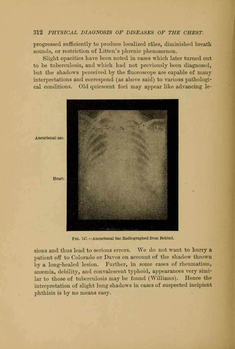 progressed sufficiently to produce localized rales, diminished breath sounds, or restriction of Litten's phrenic phenomenon. Slight opacities have been noted in cases which later turned out to be tuberculosis, and which had not previously been diagnosed, but the shadows perceived by the fluoroscope are capable of many interpretations and correspond (as above said) to various pathologi- cal conditions. Old quiescent foci may appear like advancing le- Aneurismal sac. Heart. Fig. 147.—Aneurismal Sac Radiographed from Behind. sions and thus lead to serious errors. We do not want to hurry a patient off to Colorado or Davos on account of the shadow thrown by a long-healed lesion. Further, in some cases of rheumatism, anaemia, debility, and convalescent typhoid, appearances very simi- lar to those of tuberculosis may be found (Williams). Hence the intrepretation of slight lung shadows in cases of suspected incipient phthisis is by no means easy.