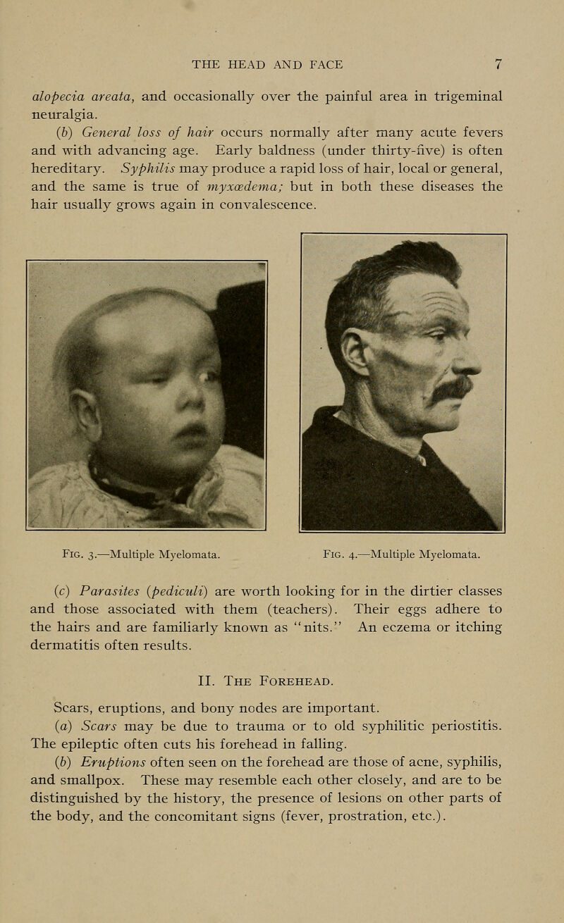 alopecia areata, and occasionally over the painful area in trigeminal neuralgia. (b) General loss of hair occurs normally after many acute fevers and with advancing age. Early baldness (under thirty-five) is often hereditary. Syphilis may produce a rapid loss of hair, local or general, and the same is true of myxoedema; but in both these diseases the hair usually grows again in convalescence. m :-■ . '■■■ .. ^q ^'M . ' % IKte. ^^L Fig. 3.—Multiple Myelomata. Fig. 4.—Multiple Myelomata. (c) Parasites (pediculi) are worth looking for in the dirtier classes and those associated with them (teachers). Their eggs adhere to the hairs and are familiarly known as nits. An eczema or itching dermatitis often results. II. The Forehead. Scars, eruptions, and bony nodes are important. (a) Scars may be due to trauma or to old syphilitic periostitis. The epileptic often cuts his forehead in falling. (b) Eruptions often seen on the forehead are those of acne, syphilis, and smallpox. These may resemble each other closely, and are to be distinguished by the history, the presence of lesions on other parts of the body, and the concomitant signs (fever, prostration, etc.).