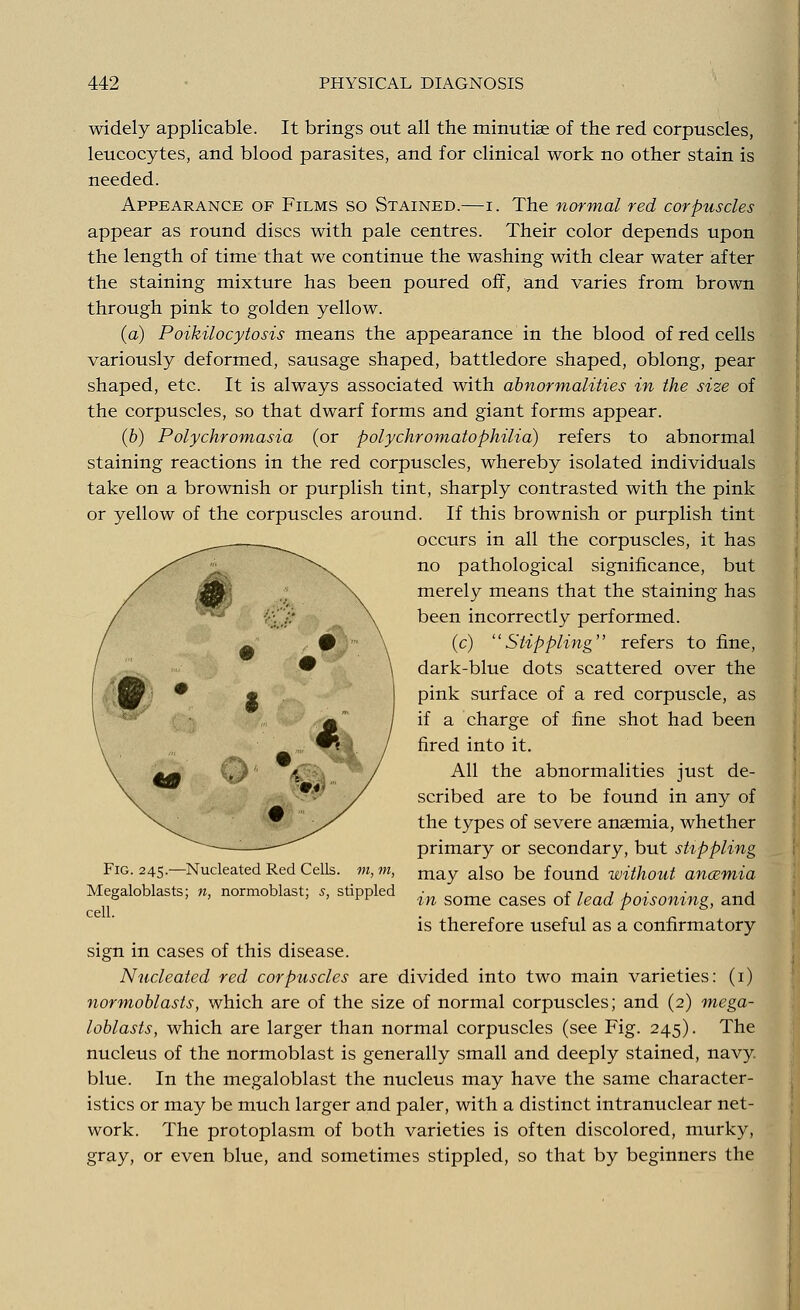 widely applicable. It brings out all the minutiae of the red corpuscles, leucocytes, and blood parasites, and for clinical work no other stain is needed. Appearance of Films so Stained.—i. The normal red corpuscles appear as round discs with pale centres. Their color depends upon the length of time that we continue the washing with clear water after the staining mixture has been poured off, and varies from brown through pink to golden yellow. (a) Poikilocytosis means the appearance in the blood of red cells variously deformed, sausage shaped, battledore shaped, oblong, pear shaped, etc. It is always associated with abnormalities in the size of the corpuscles, so that dwarf forms and giant forms appear. (b) Polychromasia (or polychromatophilia) refers to abnormal staining reactions in the red corpuscles, whereby isolated individuals take on a brownish or purplish tint, sharply contrasted with the pink or yellow of the corpuscles around. If this brownish or purplish tint occurs in all the corpuscles, it has no pathological significance, but merely means that the staining has been incorrectly performed. (c) Stippling refers to fine, dark-blue dots scattered over the pink surface of a red corpuscle, as if a charge of fine shot had been fired into it. All the abnormalities just de- scribed are to be found in any of the types of severe anaemia, whether primary or secondary, but stippling may also be found without ancemia in some cases of lead poisoning, and is therefore useful as a confirmatory sign in cases of this disease. Nucleated red corpuscles are divided into two main varieties: (i) normoblasts, which are of the size of normal corpuscles; and (2) mega- loblasts, which are larger than normal corpuscles (see Fig. 245). The nucleus of the normoblast is generally small and deeply stained, navy blue. In the megaloblast the nucleus may have the same character- istics or may be much larger and paler, with a distinct intranuclear net- work. The protoplasm of both varieties is often discolored, murky, gray, or even blue, and sometimes stippled, so that by beginners the Fig. 245.—Nucleated Red Cells, m, m, Megaloblasts; n, normoblast; s, stippled cell.