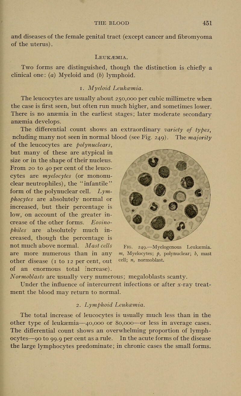 and diseases of the female genital tract (except cancer and fibre-myoma of the uterus). Leukemia. Two forms are distinguished, though the distinction is chiefly a clinical one: (a) Myeloid and (b) lymphoid. i. Myeloid Leukcemia. The leucocytes are usually about 250,000 per cubic millimetre when the case is first seen, but often run much higher, and sometimes lower. There is no anaemia in the earliest stages; later moderate secondary anaemia develops. The differential count shows an extraordinary variety of types, ncluding many not seen in normal blood (see Fig. 249). The majority of the leucocytes are polynuclears, but many of these are atypical in size or in the shape of their nucleus. From 20 to 40 per cent of the leuco- cytes are myelocytes (or mononu- clear neutrophiles), the infantile form of the polynuclear cell. Lym- phocytes are absolutely normal or increased, but their percentage is low, on account of the greater in- crease of the other forms. Eosino- philes are absolutely much in- creased, though the percentage is not much above normal. Mast cells are more numerous than in an}5- other disease (1 to 12 per cent, out of an enormous total increase). Normoblasts are usually very numerous; megaloblasts scanty. Under the influence of intercurrent infections or after rr-ray treat- ment the blood may return to normal. 2. Lymphoid Leukcemia. The total increase of leucocytes is usually much less than in the other type of leukaemia—40,000 or 80,000—or less in average cases. The differential count shows an overwhelming proportion of lymph- ocytes—90 to 99.9 per cent as a rule. In the acute forms of the disease the large lymphocytes predominate; in chronic cases the small forms. Fig. 249.—Myelogenous Leukaemia. m, Myelocytes; p, polynuclear; b, mast cell; n, normoblast.