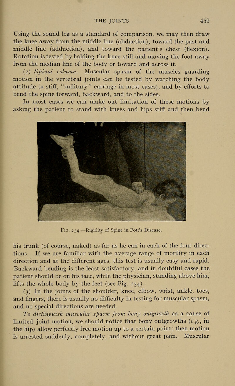 Using the sound leg as a standard of comparison, we may then draw the knee away from the middle line (abduction), toward the past and middle line (adduction), and toward the patient's chest (flexion). Rotation is tested by holding the knee still and moving the foot away from the median line of the body or toward and across it. (2) Spinal column. Muscular spasm of the muscles guarding motion in the vertebral joints can be tested by watching the body attitude (a stiff, military carriage in most cases), and by efforts to bend the spine forward, backward, and to the sides. In most cases We can make out limitation of these motions by asking the patient to stand with knees and hips stiff and then bend Fig. 254.—Rigidity of Spine in Pott's Disease. his trunk (of course, naked) as far as he can in each of the four direc- tions. If we are familiar with the average range of motility in each direction and at the different ages, this test is usually easy and rapid. Backward bending is the least satisfactory, and in doubtful cases the patient should be on his face, while the physician, standing above him, lifts the whole body by the feet (see Fig. 254). (3) In the joints of the shoulder, knee, elbow, wrist, ankle, toes, and fingers, there is usually no difficulty in testing for muscular spasm, and no special directions are needed. To distinguish muscular spasm from bony outgrowth as a cause of limited joint motion, we should notice that bony outgrowths (e.g., in the hip) allow perfectly free motion up to a certain point; then motion is arrested suddenly, completely, and without great pain. Muscular