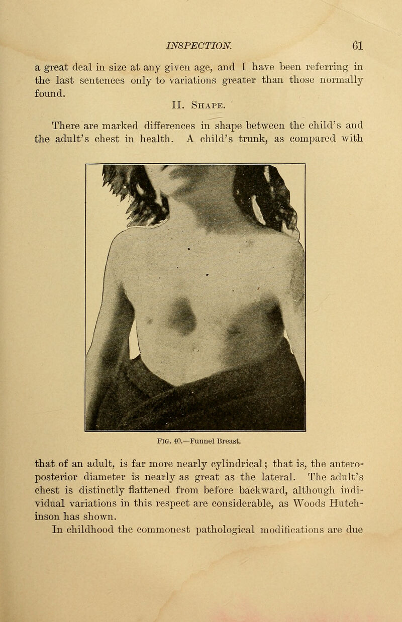 a great deal in size at any given age, and I have been referring in the last sentences only to variations greater than those normally found. II. Shape. There are marked differences in shape between the child's and the adult's chest in health. A child's trunk, as compared with Fig. 40.—Funnel Breast. that of an adult, is far more nearly cylindrical; that is, the antero- posterior diameter is nearly as great as the lateral. The adult's chest is distinctly flattened from before backward, although indi- vidual variations in this respect are considerable, as Woods Hutch- inson has shown. In childhood the commonest pathological modifications are due