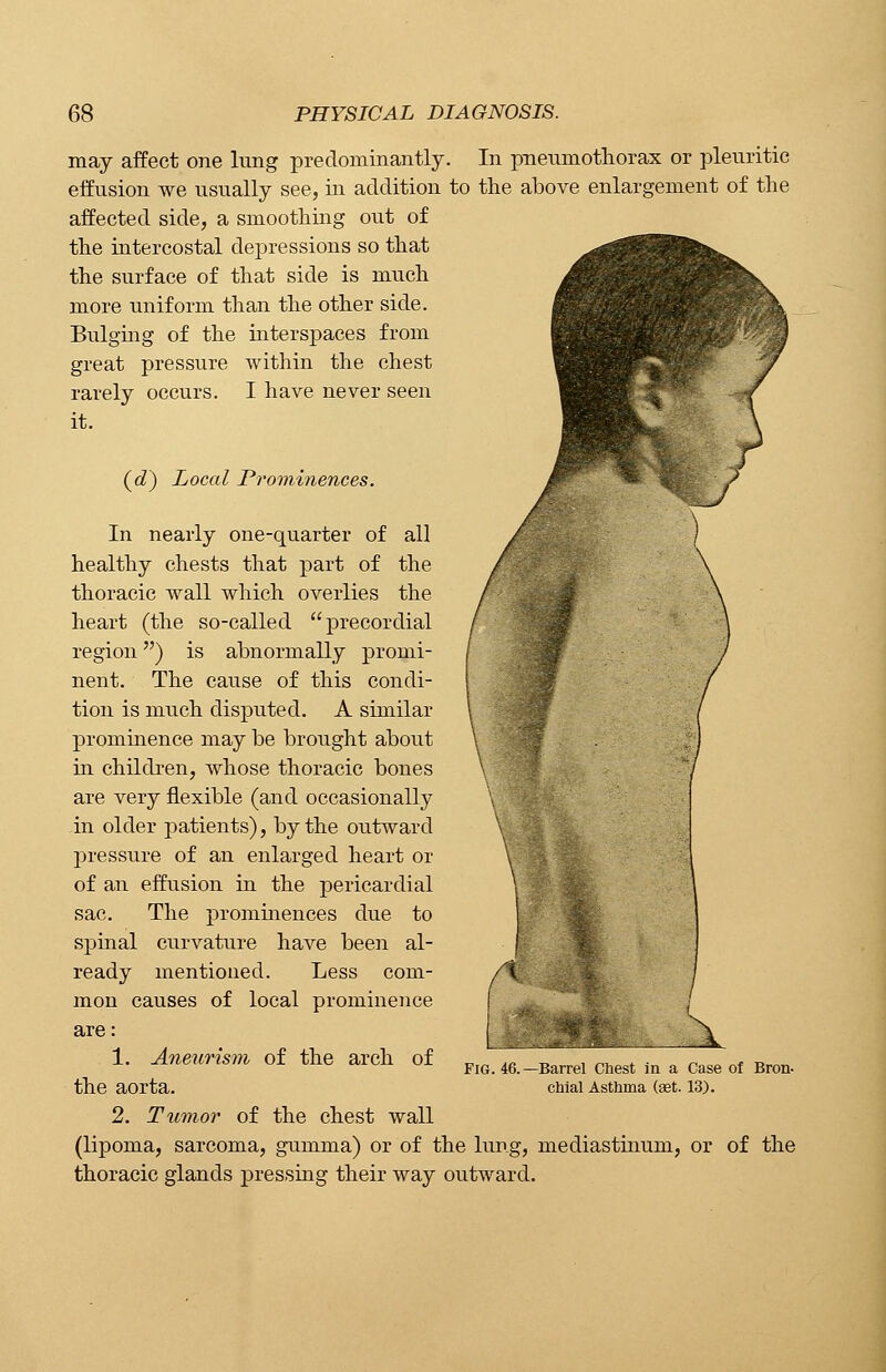 may affect one lung predominantly. In pneumothorax or pleuritic effusion we usually see, in addition to the above enlargement of the affected side, a smoothing out of the intercostal depressions so that the surface of that side is much more uniform than the other side. Bulging of the interspaces from great pressure within the chest rarely occurs. I have never seen it. (d) Local Prominences. In nearly one-quarter of all healthy chests that part of the thoracic wall which overlies the heart (the so-called precordial region) is abnormally promi- nent. The cause of this condi- tion is much disputed. A similar prominence may be brought about in children, whose thoracic bones are very flexible (and occasionally in older patients), by the outward pressure of an enlarged heart or of an effusion in the pericardial sac. The prominences due to spinal curvature have been al- ready mentioned. Less com- mon causes of local prominence are: 1. Aneurism of the arch of the aorta. 2. Tumor of the chest wall (lipoma, sarcoma, gumma) or of the lung, mediastinum, or of the thoracic glands pressing their way outward. fig. 46. Barrel Chest in a Case of Bron- chial Asthma (set. 13).