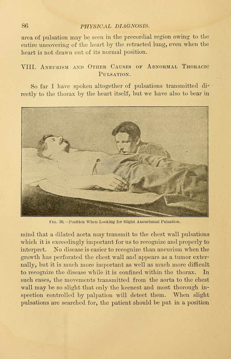 area of pulsation may be seen in the precordial region owing to the entire uncovering of the heart by the retracted lung, even when the heart is not drawn out of its normal position. VIII. Aneurism and Other Causes of Abnormal Thoracic Pulsation. So far I have spoken altogether of pulsations transmitted di- rectly to the thorax by the heart itself, but we have also to bear in I'IG. 59.—Position When Looking for Slight Aneurysmal Pulsation. mind that a dilated aorta may transmit to the chest wall pulsations which it is exceedingly important for us to recognize and properly to interpret. No disease is easier to recognize than aneurism when the growth has perforated the chest wall and appears as a tumor exter- nally, but it is much more important as well as much more difficult to recognize the disease while it is confined within the thorax. In such cases, the movements transmitted from the aorta to the chest wall may be so slight that only the keenest and most thorough in- spection controlled by palpation will detect them. When slight pulsations are searched for, the patient should be put in a position