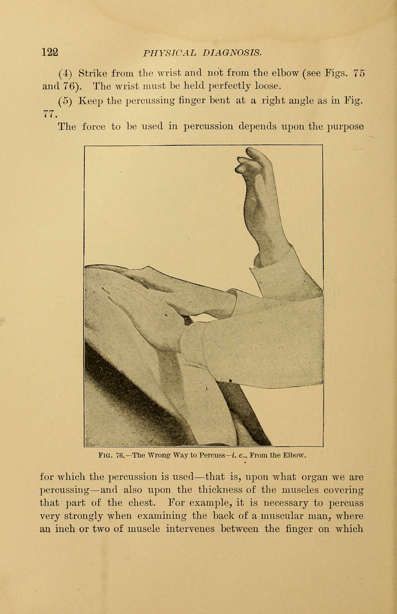 (4) Strike from the wrist and not from the elbow (see Figs. 75 and 76). The wrist must he held perfectly loose. (5) Keep the percussing finger bent at a right angle as hi Fig. 77. The force to be used in percussion depends upon the purpose Fig. 76.—The Wrong Way to Percuss—i. e., From the Elbow. for which the percussion is used—that is, upon what organ we are percussing—and also upon the thickness of the muscles covering that part of the chest. For example, it is necessary to percuss very strongly when examining the back of a muscular man, where an inch or two of muscle intervenes between the finger on which