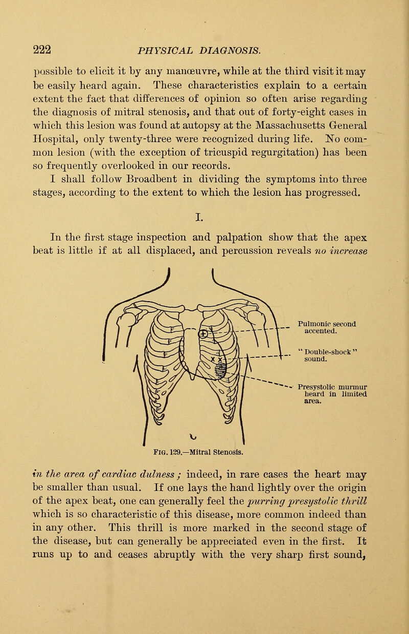 passible to elicit it by any manoeuvre, while at the third visit it may be easily heard again. These characteristics explain to a certain extent the fact that differences of opinion so often arise regarding the diagnosis of mitral stenosis, and that out of forty-eight cases in which this lesion was found at autopsy at the Massachusetts General Hospital, only twenty-three were recognized during life. No com- mon lesion (with the exception of tricuspid regurgitation) has been so frequently overlooked in our records. I shall follow Broadbent in dividing the symptoms into three stages, according to the extent to which the lesion has progressed. In the first stage inspection and palpation show that the apex beat is little if at all displaced, and percussion reveals no increase Pulmonic second accented.  Double-stock' sound. Presystolic murmur heard in limited area. Fig. 129.—Mitral Stenosis. in the area of cardiac dulness ; indeed, in rare cases the heart may be smaller than usual. If one lays the hand lightly over the origin of the apex beat, one can generally feel the purring presystolic thrill which is so characteristic of this disease, more common indeed than in any other. This thrill is more marked in the second stage of the disease, but can generally be appreciated even in the first. It runs up to and ceases abruptly with the very sharp first sound,