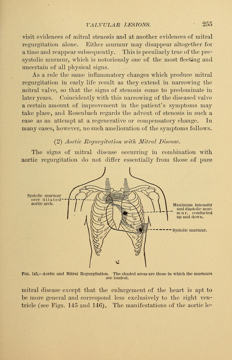 visit evidences of mitral stenosis and at another evidences of mitral regurgitation alone. Either murmur may disappear altogether for a time and reappear subsequently. This is peculiarly true of the pre- systolic murmur, which is notoriously one of the most fleeting and uncertain of all physical signs. As a rule the same inflammatory changes which produce mitral regurgitation in early life result as they extend in narrowing the mitral valve, so that the signs of stenosis come to predominate in later years. Coincidently with this narrowing of the diseased valve a certain amount of improvemeut in the patient's symptoms may take place, and Rosenbach regards the advent of stenosis in such a case as an attempt at a regenerative or compensatory change. In many cases, however, no such amelioration of the symptoms follows. (2) Aortic Regurgitation with Mitral Disease. The signs of mitral disease occurring in combination with aortic regurgitation do not differ essentially from those .of pure Systolic murmur over dilated-~i[--Y- aortic arch. Maximum intensity and diastolic mur- m u r, conducted up and down. Systolic murmur. Fig. 145.—Aortic and Mitral Regurgitation. The shaded areas are those in which the murmurs are loudest. mitral disease except that the enlargement of the heart is apt to be more general and correspond less exclusively to the right ven- tricle (see Figs. 145 and 146). The manifestations of the aortic le-