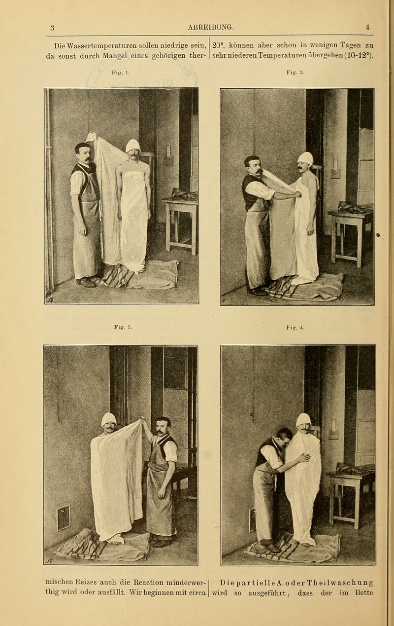 ABREIBUNG. Die Wasserternperaturen sollen niedrige sein, da sonst durch Mangel eines gehörigen ther- Fig. l. 20°. können aber schon in wenigen Tagen zu sehr niederen Temperaturen übergehen (10-12°). Fig. 2. Fig. 3. mischen Reizes auch die Reaction minderwer- thig wird oder ausfällt. Wir beginnen mit circa DiepartielleA. oderTheilwaschung wird so ausgeführt, dass der im Bette