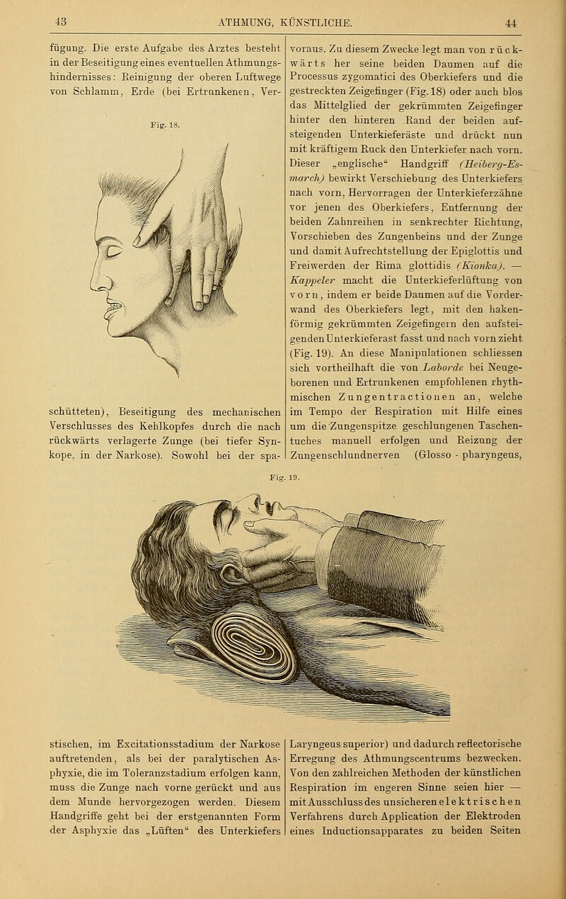 fügung. Die erste Aufgabe des Arztes besteht in der Beseitigung eines eventuellen Athrnungs- hindernisses: Reinigung der oberen Luftwege von Schlamm, Erde (bei Ertrunkenen, Ver- Fig. 18. schütteten), Beseitigung des mechanischen Verschlusses des Kehlkopfes durch die nach rückwärts verlagerte Zunge (bei tiefer Syn- kope, in der Narkose). Sowohl bei der spa- voraus. Zu diesem Zwecke legt man von rück- wärts her seine beiden Daumen auf die Processus zygomatici des Oberkiefers und die gestreckten Zeigefinger (Fig. 18) oder auch blos das Mittelglied der gekrümmten Zeigefinger hinter den hinteren Rand der beiden auf- steigenden ünterkieferäste und drückt nun mit kräftigem Ruck den Unterkiefer nach vorn. Dieser „englische Handgriff (Heiberg-Es- marcli) bewirkt Verschiebung des Unterkiefers nach vorn. Hervorragen der Unterkieferzähne vor jenen des Oberkiefers, Entfernung der beiden Zahnreihen in senkrechter Richtung, Vorschieben des Zungenbeins und der Zunge und damit Aufrechtstellung der Epiglottis und Freiwerden der Rima glottidis (Kionka). — Kappeier macht die Unterkieferlüftung von vorn, indem er beide Daumen auf die Vorder- wand des Oberkiefers legt, mit den haken- förmig gekrümmten Zeigefingern den aufstei- genden Unterkieferast fasst und nach vorn zieht (Fig. 19). An diese Manipulationen schliessen sich vortheilhaft die von Laborde bei Neuge- borenen und Ertrunkenen empfohlenen rhyth- mischen Zungentr actio neu an, welche im Tempo der Respiration mit Hilfe eines um die Zungenspitze geschlungenen Taschen- tuches manuell erfolgen und Reizung der Zungenschlundnerven (Glosso • pharyngeus, stischen, im Excitationsstadium der Narkose auftretenden, als bei der paralytischen As- phyxie, die im Toleranzstadium erfolgen kann, muss die Zunge nach vorne gerückt und aus dem Munde hervorgezogen werden. Diesem Handgriffe geht bei der erstgenannten Form der Asphyxie das „Lüften des Unterkiefers Laryngeus superior) und dadurch reflectorische Erregung des Athmungscentrums bezwecken. Von den zahlreichen Methoden der künstlichen Respiration im engeren Sinne seien hier — mit Ausschluss des unsicheren elektrischen Verfahrens durch Application der Elektroden eines Inductionsapparates zu beiden Seiten