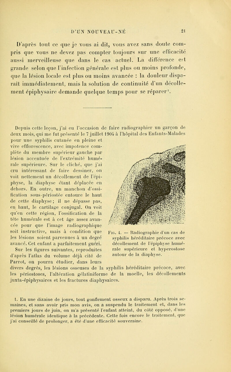 D'après tout ce que je vous ai dit, vous avez sans doute com- pris que vous ne devez pas compter toujours sur une efficacité aussi merveilleuse que dans le cas actuel. La différence eet grande selon que l'infection générale est plus ou moins profonde, que la lésion locale est plus ou moins avancée : la douleur dispa- raît immédiatement, mais la solution de continuité d'un décoUc'^ ment épiphysaire demande quelque temps pour se réparer'. Depuis cette leçon, j'ai eu l'occasion de faire radiographier un garçon de deux mois, qui me fut présenté le 7 juillet 1904 à l'hôpital des Enfants-Malades pour une syphilis cutanée en pleine et vive efflorescence, avec impotence com- plète du membre supérieur gauche par lésion accentuée de l'extrémité humé- raie supérieure. Sur le cliché, que j'ai cru intéressant de faire dessiner, on voit nettement un décollement de l'épi- physe, la diaphyse étant déplacée en dehors. En outre, un manchon d'ossi- fication sous-périostée entoure le haut de cette diaphyse ; il ne dépasse pas, en haut, le cartilage conjugal. On voit qu'en cette région, l'ossification de la tête humérale est à cet âge assez avan- cée pour que l'image radiographique soit instructive, mais à condition que les lésions soient parvenues à un degré avancé. Cet enfant a parfaitement guéri. Sur les figures suivantes, reproduites d'après l'atlas du volume déjà cité de Parrot, on pourra étudier, dans leurs divers degrés, les lésions osseuses de la syphilis héréditaire précoce, avec les périostoses, l'altération gélatiniforme de la moelle, les décollements juxta-épiphysaires et les fractures diaphysaires. FiG. 4. — Radiographie d'un cas de syphilis héréditaire précoce avec décollement de l'épiphyse humé- rale supérieure et hyperostose autour de la diaphyse. 1. En une dizaine de jours, tout gonflement osseux a disparu. Après ti'ois se- maines, et sans avoir pris mon avis, on a suspendu le traitement et, dans les premiers jours de juin, on m'a présenté l'enfant atteint, du côté opposé, d'une lésion humérale identique à la précédente. Cette fois encore le traitement, que j'ai conseillé de prolonger, a été d'une efficacité souveraine.