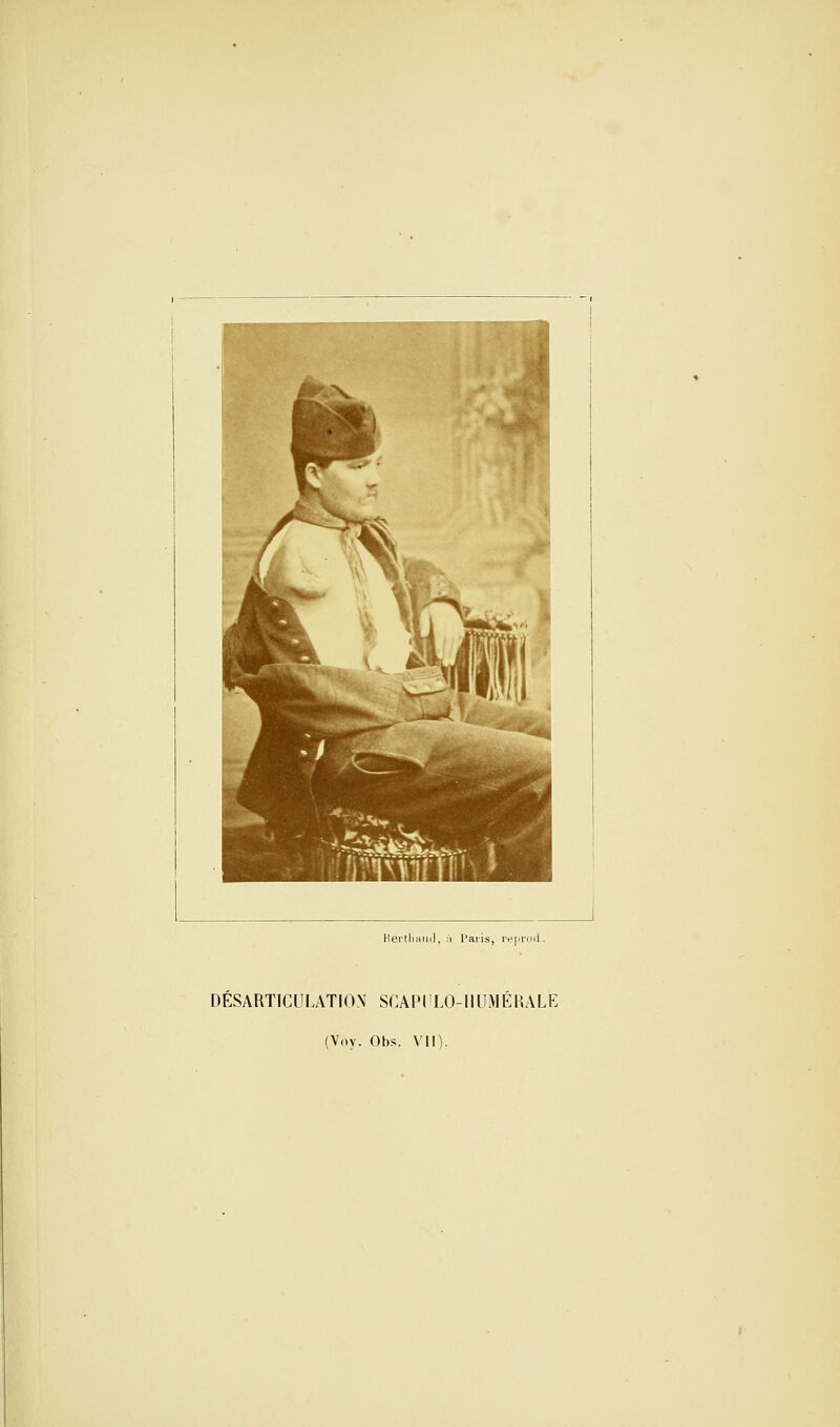 DESARTICULATION SCAP11L0-IIUMERALE (Voy. Obs. VII).