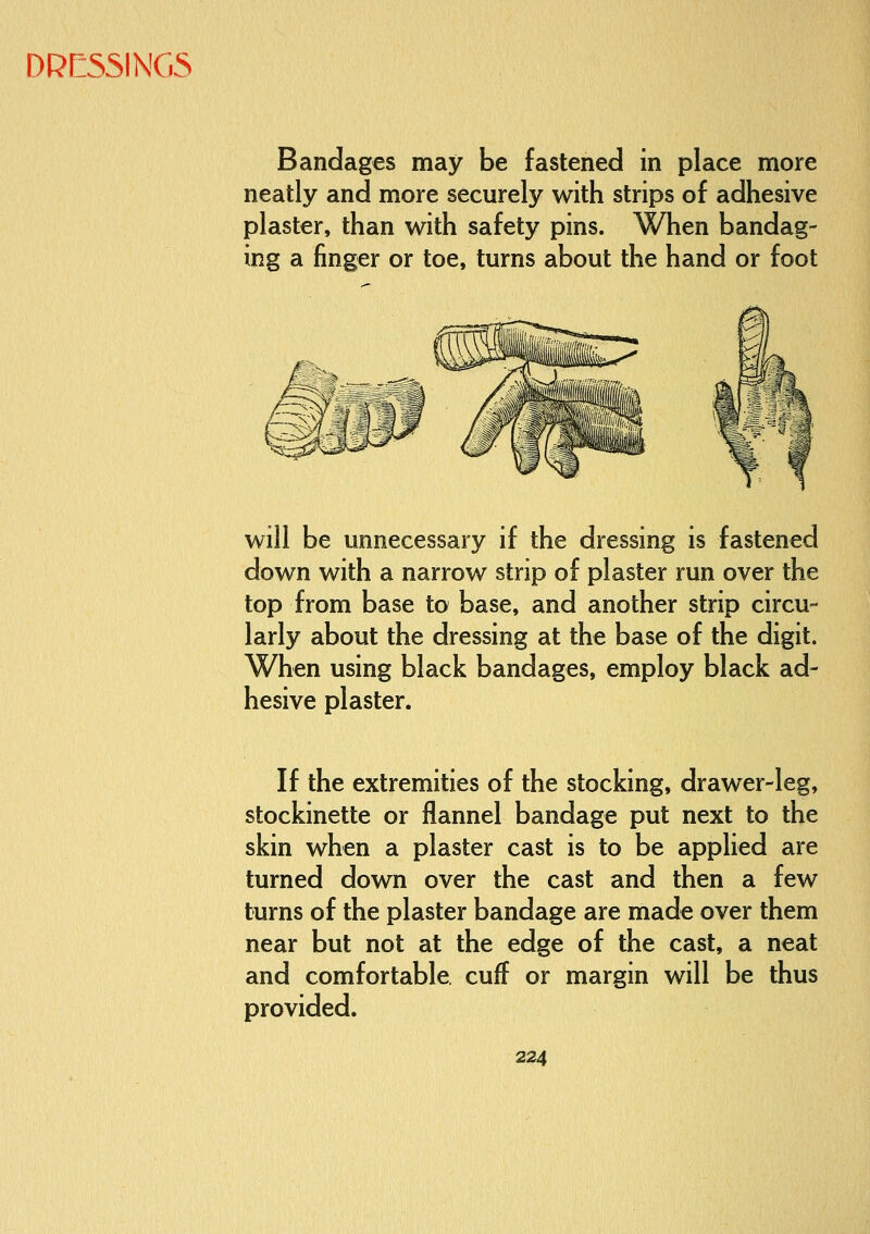 Bandages may be fastened in place more neatly and more securely with strips of adhesive plaster, than with safety pins. When bandag- ing a finger or toe, turns about the hand or foot will be unnecessary if the dressing is fastened down with a narrow strip of plaster run over the top from base to base, and another strip circu- larly about the dressing at the base of the digit. When using black bandages, employ black ad- hesive plaster. If the extremities of the stocking, drawer-leg, stockinette or flannel bandage put next to the skin when a plaster cast is to be applied are turned down over the cast and then a few turns of the plaster bandage are made over them near but not at the edge of the cast, a neat and comfortable, cuff or margin will be thus provided.