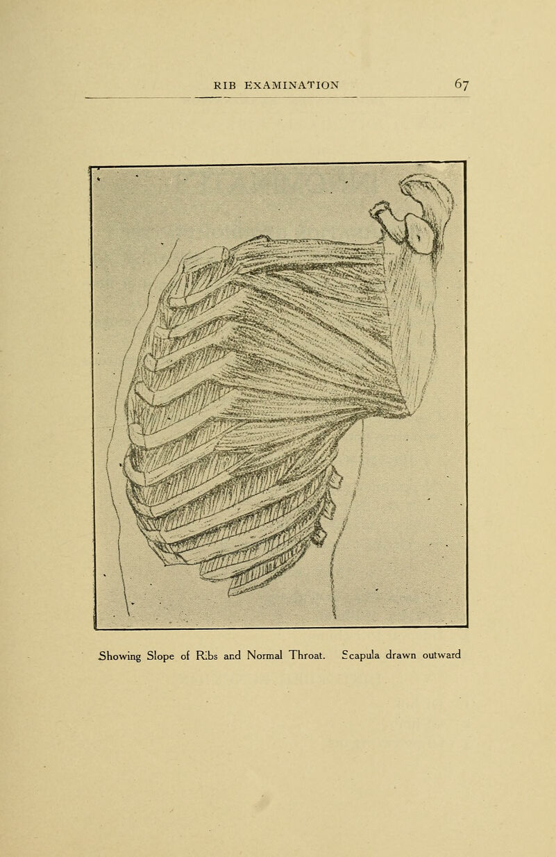 Showing Slope of Ribs and Normal Throat. Scapula drawn outward