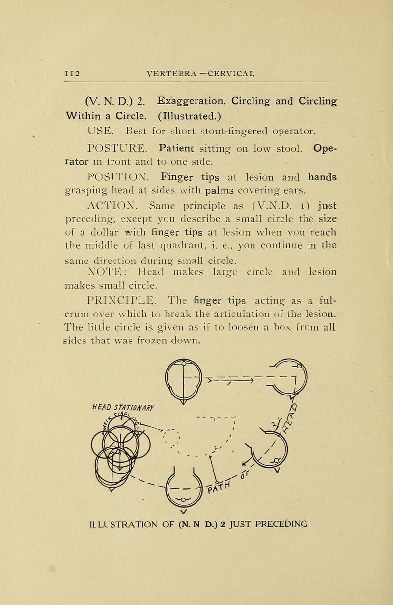 (V. N. D.) 2. Exaggeration, Circling and Circling Within a Circle. (Illustrated.) USE. Best for short stout-fingered operator. POSTURE. Patient sitting on low stool. Ope- rator in front and to one side. POSITION. Finger tips at lesion and hands grasping, head at sides with palms covering ears. ACTION. Same principle as (V.N.D. i) just preceding, except you describe a small circle the size of a dollar with finger tips at lesion when you reach the middle of last quadrant, i. e., you continue in the same direction during small circle. NOTE: Head makes large circle and lesion makes small circle. PRINCIPLE. The finger tips acting as a ful- crum over which to break the articulation of the lesion.' The little circle is given as if to loosen a box from all sides that was frozen down. ILLLSTRATION OF (N.N D.) 2 JUST PRECEDING