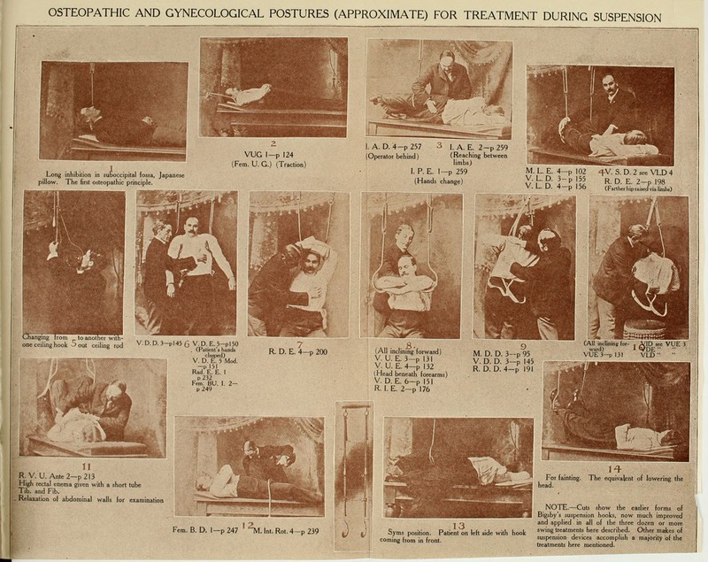 OSTEOPATHIC AND GYNECOLOGICAL POSTURES (APPROXIMATE) FOR TREATMENT DURING SUSPENSION hanging Irom to anoti le ceiling hook 3 out ilmg tod V. D. D. 3-p 145 6 V D, E. 5--p 150 . (rabent B hands claBped) V. D. E. 5 Mod. -P 151 Rad. E. E. 1 p232 Fem. BU. 1. 2- 7 R D. E. 4—p 200 o _ (All inclining forward) V. U. E. 3-pl3l V. U. E, 4-p 132 (Head beneath (o V. D. E. 6-p 151 RLE. 2-p 176 M. D. D. 3—p 95 V. D. D. 3—p 145 R. D. D. 4-p 191 (All incUnB for- , J/ID see VUE 3 ward) 1 QdE  ■■ VUE 3-p 131 VLD •■ R. V.U. Ante2—p213 High rectal enema given with { Tib. and Fib. . Relaxation of abdominal wal short tube for examination Fern. B. D. 1-p 247 -TVl. Int. Rot. 4-p 239 For fainting. The equivalent of lowering the head. NOTE.—Cuts show the earlier forms of Bigsby's suspension hooks, now much improved and applied in all of the three dozen or more swing treatments here described. Other makes of suspension devices accomplish a majority of the treatments here mentioned.