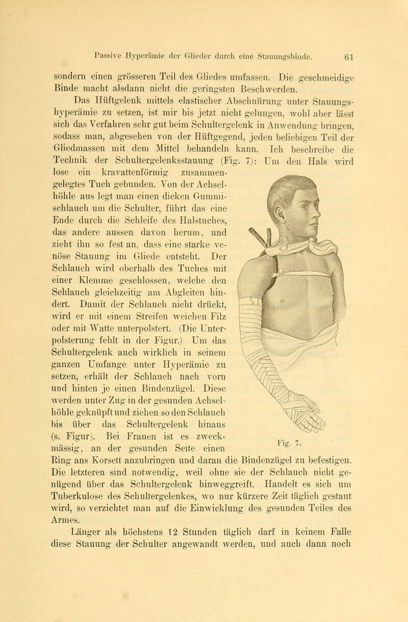 sondern einen grösseren Teil des Gliedes umfassen. Die geschmeidige Binde macht alsdann nicht die geringsten Beschwerden. Das Hüftgelenk mittels elastischer Abschnürung unter Stauungs- hyperämie zu setzen, ist mir bis jetzt nicht gelungen, wohl aber lässt sich das Verfahren sehr gut beim Schultergelenk in Anwendung bringen, sodass man, abgesehen von der Hüftgegend, jeden beliebigen Teil der Gliedmassen mit dem Mittel behandeln kann. Ich beschreibe die Technik der Schultergelenksstauung (Fig. 7): Um den Hals wird lose ein kravattenförmig zusammen- gelegtes Tuch gebunden. Von der Achsel- höhle aus legt man einen dicken Gummi- schlauch um die Schulter, führt das eine Ende durch die Schleife des Halstuches, das andere aussen davon herum, und zieht ihn so fest an, dass eine starke ve- nöse Stauung im Gliede entsteht. Der Schlauch wird oberhalb des Tuches mit einer Klemme geschlossen, welche den / Schlauch gleichzeitig am Abgleiten bin- ■• dert. Damit der Schlauch nicht drückt, wird er mit einem Streifen weichen Filz j oder mit Watte unterpolstert. (Die Unter- ' Polsterung fehlt in der Figur.) Um das Schultergelenk auch wirklich in seinem ganzen Umfange unter Hyperämie zu setzen, erhält der Schlauch nach vorn und hinten je einen Bindenzügel. Diese werden unter Zug in der gesunden Achsel- höhle geknüpft und ziehen so den Schlauch bis über das Schultergelenk hinaus (s. Figur). Bei Frauen ist es zweck- mässig, an der gesunden Seite einen Ring ans Korsett anzubringen und daran die Bindenzügel zu befestigen. Die letzteren sind notwendig, weil ohne sie der Schlauch nicht ge- nügend über das Schultergelenk hinweggreift. Handelt es sich um Tuberkulose des Schultergelenkes, wo nur kürzere Zeit täglich gestaut wird, so verzichtet man auf die Einwicklung des gesunden Teiles des Armes. Länger als höchstens 12 Stunden täglich darf in keinem Falle diese Stauung der Schulter angewandt werden, und auch dann noch J: Fiff.