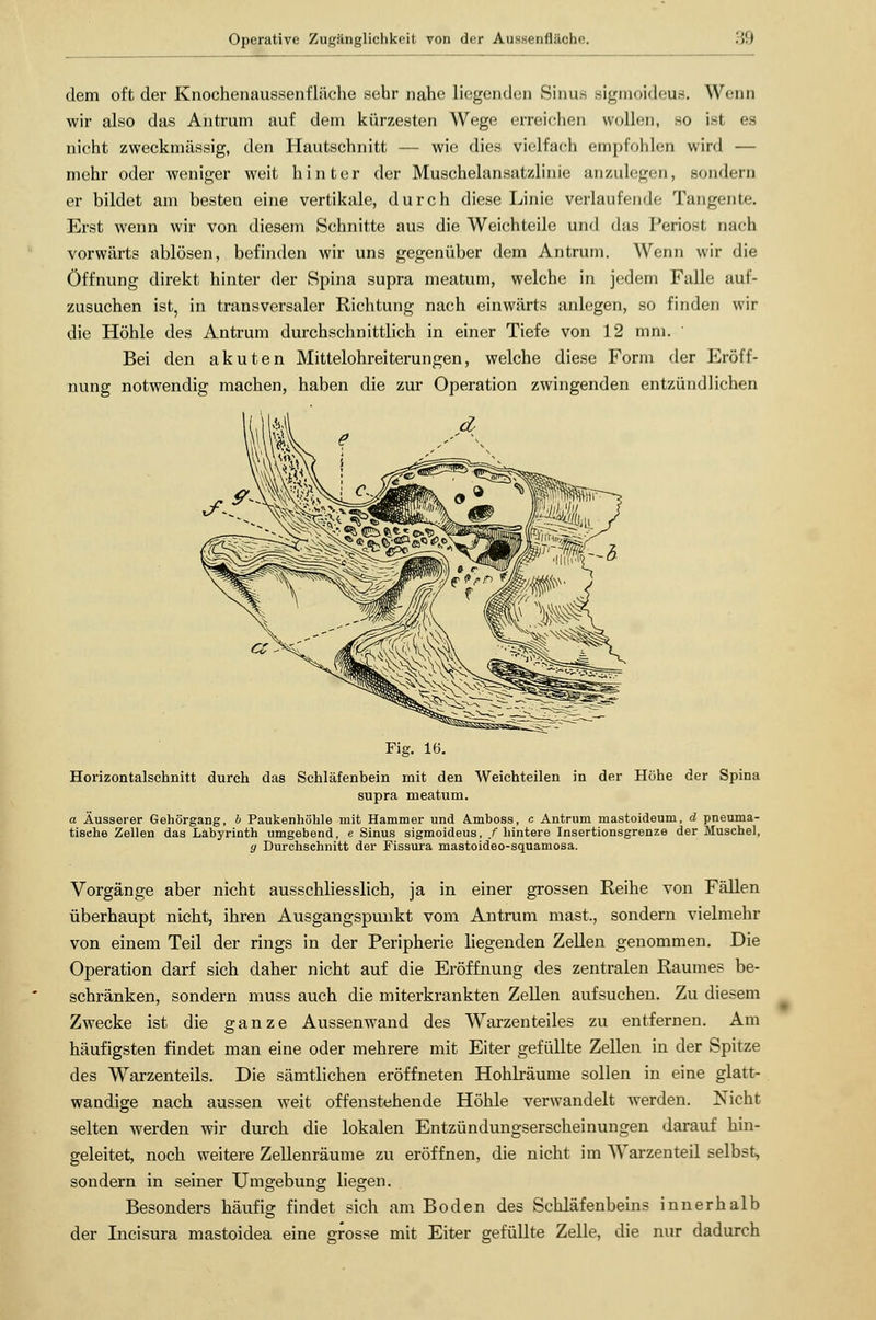 dem oft der Knochenaussenfläche sehr nahe liegenden Sinus sigmoidcus. Wenn wir also das Antrum auf dem kürzesten Wege erreichen «vollen, so ist es nicht zweckmässig, den Hautschnitt — wie dies vielfach empfohlen wird — mehr oder weniger weit hinter der Muschelansatzlinie anzulegen, sondern er bildet am besten eine vertikale, durch diese Linie verlaufende Tangente. Erst wenn wir von diesem Schnitte aus die Weichteile und das Periost nach vorwärts ablösen, befinden wir uns gegenüber dem Antrum. Wenn wir die Öffnung direkt hinter der Spina supra meatum, welche in jedem Falle auf- zusuchen ist, in transversaler Richtung nach einwärts anlegen, so finden wir die Höhle des Antrum durchschnittlich in einer Tiefe von 12 mm. Bei den akuten Mittelohreiterungen, welche diese Form der Eröff- nung notwendig machen, haben die zur Operation zwingenden entzündlichen Fig. 16. Horizontalschnitt durch das Schläfenbein mit den Weichteilen in der Höhe der Spina supra meatum. a Äusserer Gehörgang, b Paukenhöhle mit Hammer und A.mboss, c Antrum mastoideum, d pneuma- tische Zellen das Labyrinth umgebend, e Sinus sigmoideus, /hintere Insertionsgrenze der Muschel, y Durchschnitt der Fissura mastoideo-squamosa. Vorgänge aber nicht ausschliesslich, ja in einer grossen Reihe von Fällen überhaupt nicht, ihren Ausgangspunkt vom Antrum mast, sondern vielmehr von einem Teil der rings in der Peripherie liegenden Zellen genommen. Die Operation darf sich daher nicht auf die Eröffnung des zentralen Raumes be- schränken, sondern muss auch die miterkrankten Zellen aufsuchen. Zu diesem Zwecke ist die ganze Aussenwand des Warzenteiles zu entfernen. Am häufigsten findet man eine oder mehrere mit Eiter gefüllte Zellen in der Spitze des Warzenteils. Die sämtlichen eröffneten Hohlräume sollen in eine glatt- wandige nach aussen weit offenstehende Höhle verwandelt werden. Nicht selten werden wir durch die lokalen Entzündungserscheinungen darauf hin- geleitet, noch weitere Zellenräume zu eröffnen, die nicht im Warzenteil selbst, sondern in seiner Umgebung liegen. Besonders häufig findet sich am Boden des Schläfenbeins innerhalb der Incisura mastoidea eine grosse mit Eiter gefüllte Zelle, die nur dadurch