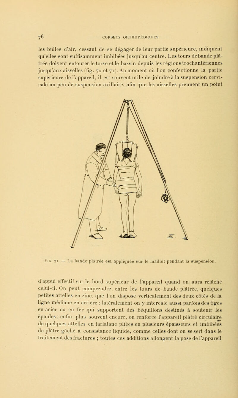 les bulles d'air, cessant de se dégager de leur partie supérieure, indiquent qu'elles sont suffisamment imbibées jusqu'au centre. Les tours débande plâ- trée doivent entourer le torse elle bassin depuis les régions trochantériennes jusqu'aux aisselles fig. 70 et 71'. Au moment où Ion confectionne la partie supérieure de l'appareil, il est souvent utile de joindre à la suspension cervi- cale un peu de suspension axillaire, afin que les aisselles prennent un point Fie. 71. — La bande plâtrée est appliquée sur le maillot pendant la suspension. d appui effectif sur le bord supérieur de l'appareil quand on aura relâché celui-ci. On peut comprendre, entre les tours de bande plâtrée, quelques petites attelles en zinc, que l'on dispose verticalement des deux côtés de la ligne médiane en arrière ; latéralement on y intercale aussi parfois des tiges en acier ou en fer qui supportent des béquillons destinés à soutenir les épaules ; enfin, plus souvent encore, on renforce l'appareil plâtré circulaire de quelques attelles en tarlatane pliées en plusieurs épaisseurs et imbibées de plâtre gâché à consistance liquide, comme celles dont on se sert dans le traitement des frac tares ; toutes ces additions allongent la pose de l'appareil
