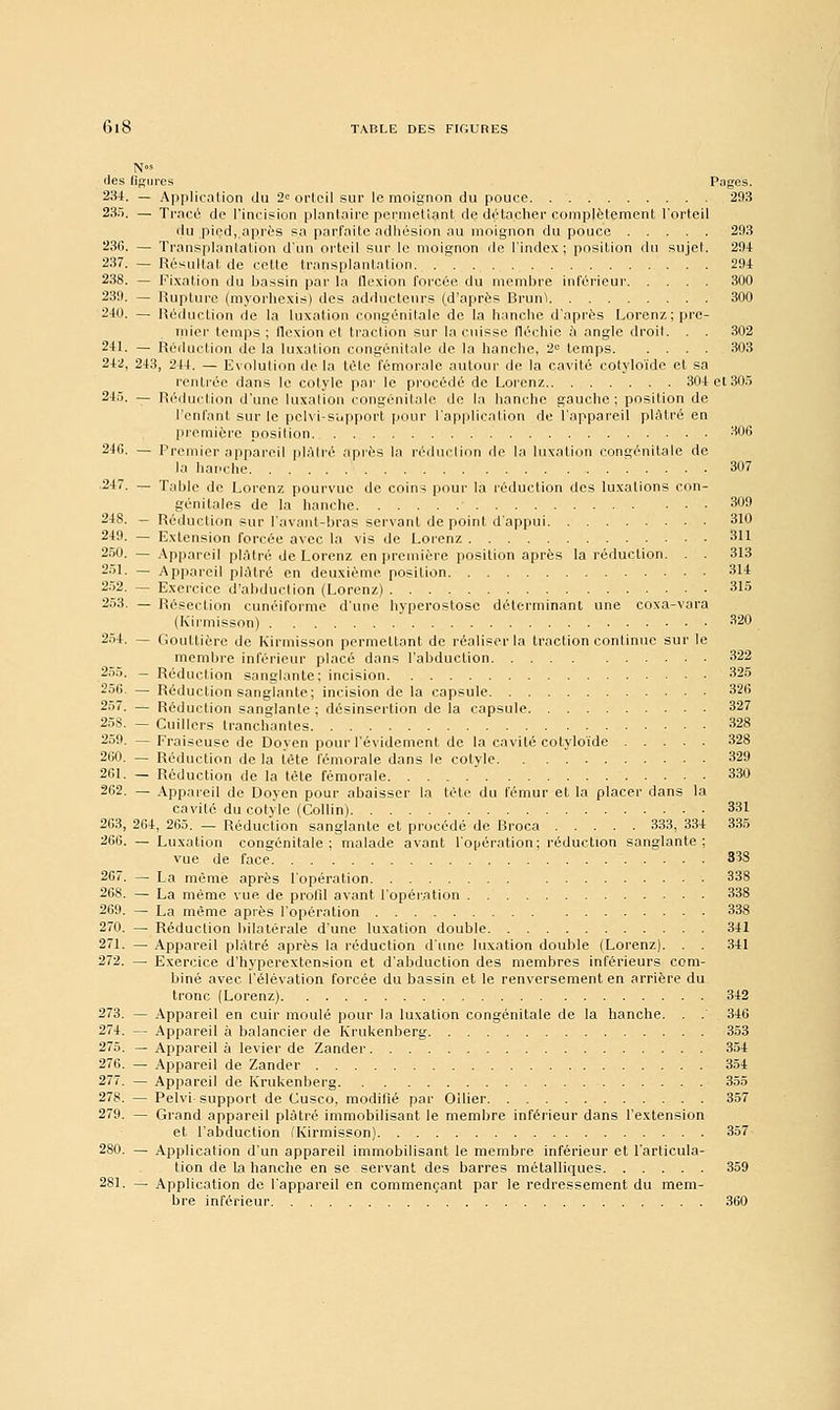 des figures Pages. 234. — Application du 2e orteil sur le moignon du pouce 293 235. — Tracé de l'incision plantaire permettant de détacher complètement l'orteil du pied, après sa parfaite adhésion au moignon du pouce 293 236. — Transplantation d'un orteil sur le moignon de l'index; position du sujet. 294 237. — Résultat de celte transplantation. '. . 294 238. — Fixation du hassin par la flexion forcée du membre inférieur 300 239. — Rupture (myorhexis) des adducteurs (d'après Rrunl 300 240. — Réduction de la luxation congénitale de la hanche d'après Lorenz; pre- mier temps ; flexion et traction sur la cuisse fléchie à angle droit. . . 302 211. — Réduction de la luxation congénitale de la hanche, 2e temps 303 242, 243, 244. — Evolution de la létc fémorale autour de la cavité cotyloïde et sa l'entrée dans le cotyle par le procédé de Lorenz 304et305 24'). — Réduction d'une luxation congénitale, de la hanche gauche; position de l'enfant sur le pclvi-support pour l'application de l'appareil plâtré en première position 306 2*6. — Premier appareil plâtré après la réduction de la luxation congénitale de la hanche 307 2-17. — Table de Lorenz pourvue de coins pour la réduction des luxations con- génitales de la hanche 309 248. — Réduction sur l'avant-bras servant de point d'appui 310 2-19. — Extension forcée avec la vis de Lorenz 311 250. — Appareil plâtré de Lorenz en première position après la réduction. . . 313 251. — Appareil plâtré en deuxième position 314 252. — Exercice d'abduction (Lorenz) 315 253. — Résection cunéiforme d'une hyperostosc déterminant une coxa-vara (Kirmisson) 320 254. — Gouttière de Kirmisson permettant de réaliser la traction continue sur le membre inférieur placé dans l'abduction 322 255. - Réduction sanglante; incision 325 256. — Réduction sanglante; incision de la capsule 326 257. — Réduction sanglante ; désinsertion de la capsule 327 25S. — Cuillers tranchantes 328 259. — Fraiseuse de Doyen pour l'évidement de la cavité cotyloïde 328 260. — Réduction de la tète fémorale dans le cotyle 329 261. — Réduction de la tète fémorale 330 262. — Appareil de Doyen pour abaisser la tète du fémur et la placer dans la cavité du cotyle (Collin) 331 263. 264, 265. — Réduction sanglante et procédé de Rroca 333, 334 335 266. — Luxation congénitale; malade avant l'opération; réduction sanglante; vue de face 338 267. — La même après l'opération 338 268. — La même vue de profil avant l'opération 338 269. — La même après l'opération 338 270. — Réduction bilatérale d'une luxation double 341 271. — Appareil plâtré après la réduction d'une luxation double (Lorenz). . . 341 272. — Exercice d'hyperextension et d'abduction des membres inférieurs com- biné avec l'élévation forcée du bassin et le renversement en arrière du tronc (Lorenz) 342 273. — Appareil en cuir moulé pour la luxation congénitale de la hanche. . . 346 274. — Appareil à balancier de Krukenberg 353 275. — Appareil à levier de Zander 354 276. — Appareil de Zander 354 277. — Appareil de Krukenberg 355 278. — Pelvi- support de Cusco, modifié par Oilier 357 279. — Grand appareil plâtré immobilisant le membre inférieur dans l'extension et l'abduction (Kirmisson) 357 280. — Application d'un appareil immobilisant le membre inférieur et l'articula- tion de la hanche en se servant des barres métalliques 359 281. — Application de l'appareil en commençant par le redressement du mem- bre inférieur 360