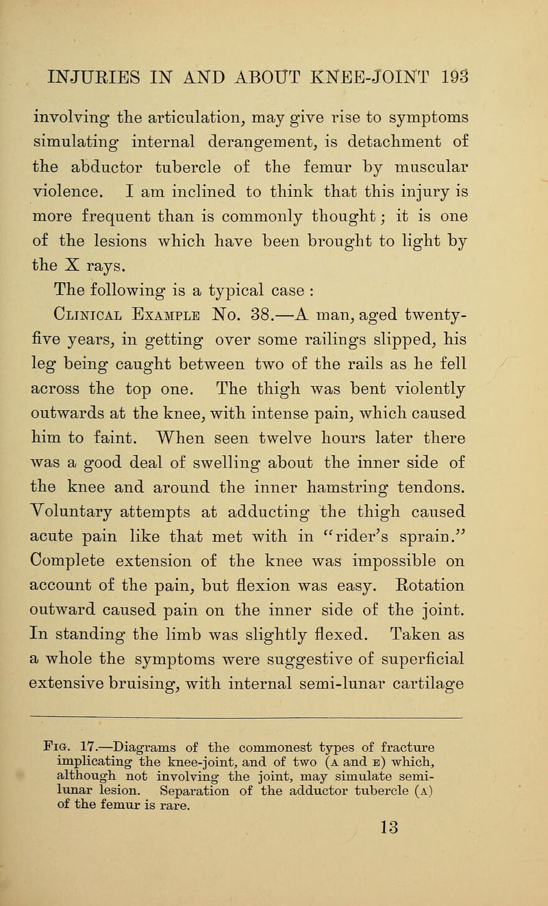 involving tlie articulation_, may give rise to symptoms simulating internal derangement, is detachment of the abductor tubercle of the femur by muscular violence. I am inclined to think that this injury is more frequent than is commonly thought; it is one of the lesions which have been brought to light by the X rays. The following is a typical case : Clintcal Example No. 38.—A man, aged twenty- five years, in getting over some railings slipped, his leg being caught between two of the rails as he fell across the top one. The thigh was bent violently outwards at the knee, with intense pain, which caused him to faint. When seen twelve hours later there was a good deal of swelling about the inner side of the knee and around the inner hamstring tendons. Voluntary attempts at adducting the thigh caused acute pain like that met with in rider^s sprain.^^ Complete extension of the knee was impossible on account of the pain, but flexion was easy. Rotation outward caused pain on the inner side of the joint. In standing the limb was slightly flexed. Taken as a whole the symptoms were suggestive of superficial extensive bruising, with internal semi-lunar cartilage Fig. 17.—Diagrams of the commonest types of fracture implicating the knee-joint, and of two (a and e) which, although not involving the joint, may simulate semi- lunar lesion. Separation of the adductor tubercle (a) of the femur is rare. 13