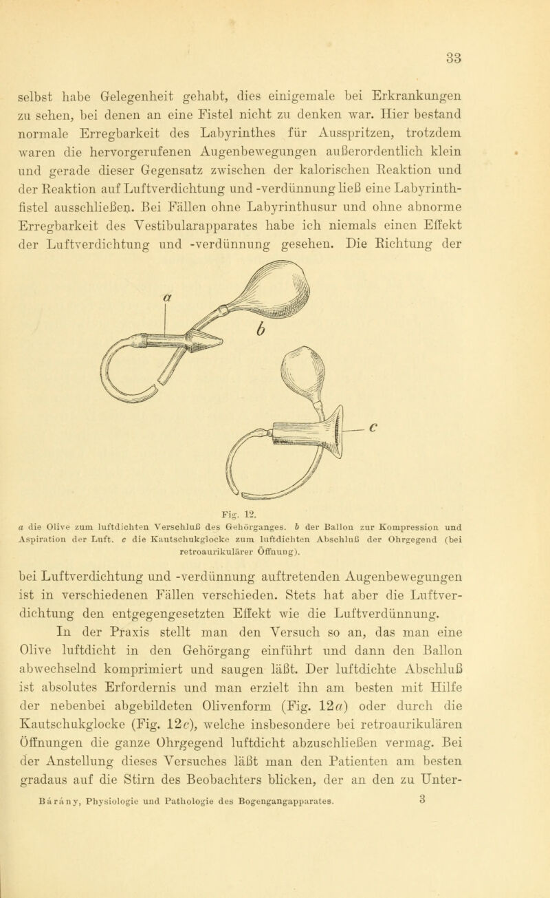 selbst habe Gelegenheit gehabt, dies einigemale bei Erkrankungen zu sehen, bei denen an eine Fistel nicht zu denken war. Hier bestand normale Erregbarkeit des Labyrinthes für Ausspritzen, trotzdem waren die hervorgerufenen Augenbewegungen außerordentlich klein und gerade dieser Gegensatz zwischen der kalorischen Reaktion und der Reaktion auf Luftverdichtung und -Verdünnung ließ eine Labyrinth- fistel ausschließen. Bei Fällen ohne Labyrinthusur und ohne abnorme Erregbarkeit des Vestibularapparates habe ich niemals einen Effekt der Luftverdichtung und -Verdünnung gesehen. Die Richtung der Fig. 12. a die Olive zum luftdichten Verschluß des Gehörganges, b der Ballon zur Kompression und Aspiration der Luft, c die Kautschukgiocke zum luftdichten Abschluß der Ohrgegend (bei retroaurikulärer Öffnung). bei Luftverdichtung und -Verdünnung auftretenden Augenbewegungen ist in verschiedenen Fällen verschieden. Stets hat aber die Luftver- dichtung den entgegengesetzten Effekt wie die Luftverdünnung. In der Praxis stellt man den Versuch so an, das man eine Olive luftdicht in den Gehörgang einführt und dann den Ballon abwechselnd komprimiert und saugen läßt. Der luftdichte Abschluß ist absolutes Erfordernis und man erzielt ihn am besten mit Hilfe der nebenbei abgebildeten Olivenform (Fig. 12 a) oder durch die Kautschukgiocke (Fig. 12c), welche insbesondere bei retroaurikulären Öffnungen die ganze Ohrgegend luftdicht abzuschließen vermag. Bei der Anstellung dieses Versuches läßt man den Patienten am besten gradaus auf die Stirn des Beobachters blicken, der an den zu Unter- Barany, Physiologie und Pathologie des Bogengangapparates. o