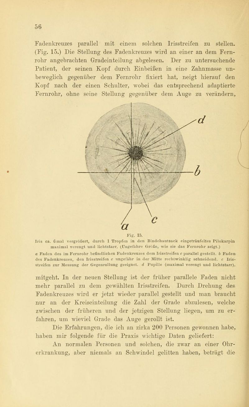 Fadenkreuzes parallel mit einem solchen Irisstreifen zu stellen» (Fig. 15.) Die Stellung des Fadenkreuzes wird an einer an dem Fern- rohr angebrachten Gradeinteilung abgelesen. Der zu untersuchende Patient, der seinen Kopf durch Einbeißen in eine Zahnmasse un- beweglich gegenüber dem Fernrohr fixiert hat, neigt hierauf den Kopf nach der einen Schulter, wobei das entsprechend adaptierte Fernrohr, ohne seine Stellung gegenüber dem Auge zu verändern? Fig. 15. Iris ca. 6 mal vergrößert, durch 1 Tropfen in den Bindehautsack eingeträufeltes Pilokarpin maximal verengt und lichtstarr. (Ungefähre Grüße, wie sie das Fernrohr zeigt.) a Faden des im Fernrohr befindlichen Fadenkreuzes dem Irisstreifen c parallel gestellt, b Faden des Fadenkreuzes, den Irisstreifen c ungefähr in der Mitte rechtwinklig schneidend, c Iris- streifen zur Messung der Gegenrollung geeignet, d Pupille (maximal verengt und lichtstarr). mitgeht. In der neuen Stellung ist der früher parallele Faden nicht mehr parallel zu dem gewählten Irisstreifen. Durch Drehung des Fadenkreuzes wird er jetzt wieder parallel gestellt und man braucht nur an der Kreiseinteilung die Zahl der Grade abzulesen, welche zwischen der früheren und der jetzigen Stellung liegen, um zu er- fahren, um wieviel Grade das Auge gerollt ist. Die Erfahrungen, die ich an zirka 200 Personen gewonnen habe, haben mir folgende für die Praxis wichtige Daten geliefert: An normalen Personen und solchen, die zwar an einer Ohr- erkrankung, aber niemals an Schwindel gelitten haben, beträgt die