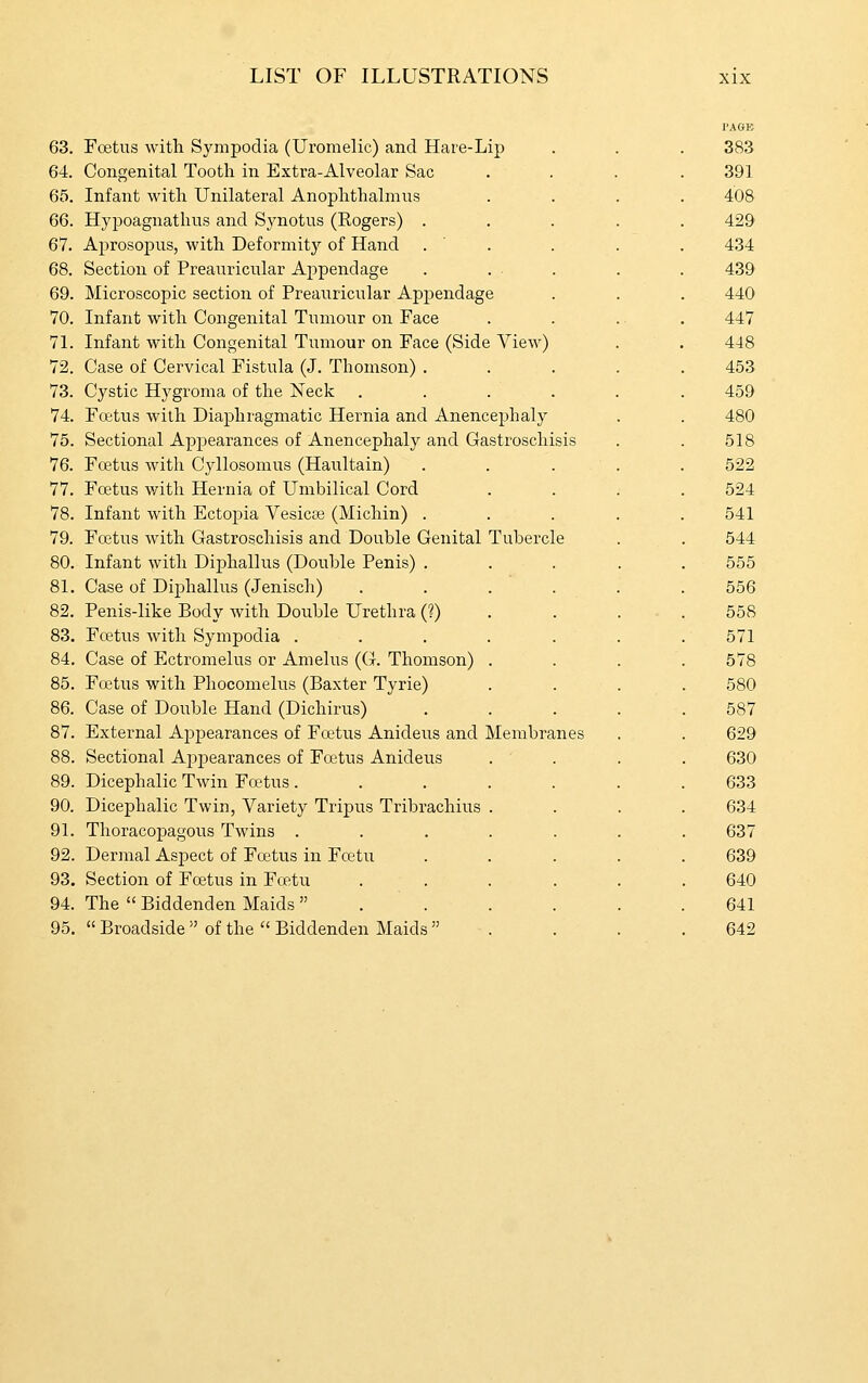 63. Foetus with. Sympodia (Uromelic) and Hare-Lip 64. Congenital Tooth in Extra-Alveolar Sac 65. Infant with Unilateral Anophthalmus 66. Hypoagnatlius and Synotus (Rogers) . 67. Aprosopus, with Deformity of Hand . ' . 68. Section of Preauricular Appendage 69. Microscopic section of Preauricular Appendage 70. Infant with Congenital Tumour on Face 71. Infant with Congenital Tumour on Face (Side View) 72. Case of Cervical Fistula (J. Thomson) . 73. Cystic Hj^groma of the Neck .... 74. Foetus with Diaphragmatic Hernia and Anencephaly 75. Sectional Appearances of Anencephaly and Gastroschisis 76. Foetus with Cyllosomus (Haultain) 77. Foetus with Hernia of Umbilical Cord 78. Infant with Ectopia Vesicas (Michin) . 79. Foetus with Gastroschisis and Double Genital Tubercle 80. Infant with Diphallus (Double Penis) . 81. Case of Diphallus (Jenisch) 82. Penis-like Body with Double Urethra (?) 83. Foetus with Sympodia . 84. Case of Ectromelus or Amelus (G. Thomson) 85. Fretus with Phocomelus (Baxter Tyrie) 86. Case of Double Hand (Dichirus) 87. External Appearances of Foetus Anideus and Membranes 88. Sectional Appearances of Foetus Anideus 89. Dicephalic Twin Foetus . 90. Dicephalic Twin, Variety Tripus Tribrachius 91. Thoracopagous Twins . 92. Dermal Aspect of Foetus in Fretu 93. Section of Foetus in Fcf;tu 94. The  Biddenden Maids  95.  Broadside  of the  Biddenden Maids  I'AGE 383 391 408 429 434 439 440 447 448 453 459 480 518 522 524 541 544 555 556 558 571 578 580 587 629 630 633 634 637 639 640 641 642