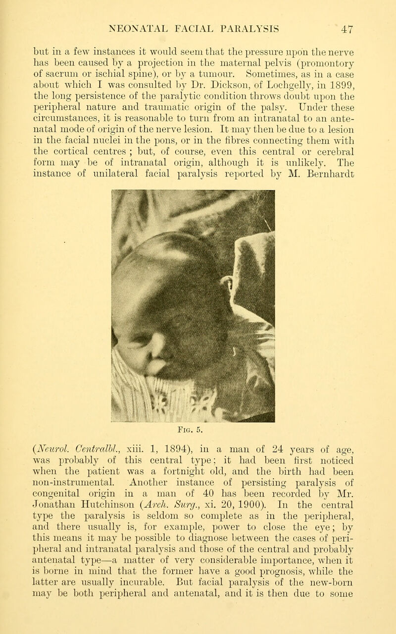 but in a few instances it would seem that the pressure upon the nerve has been caused by a projection in the maternal pelvis (promontory of sacrum or ischial spine), or by a tumour. Sometimes, as in a case about which I was consulted by Dr. Dickson, of Lochgelly, in 1899, the long persistence of the paralytic condition throws doubt upon the peripheral nature and traumatic origin of the palsy. Under these circumstances, it is reasonable to turn from an intranatal to an ante- natal mode of origin of the nerve lesion. It may then be due to a lesion in the facial nuclei in the pons, or in the fibres connecting them with the cortical centres ; but, of course, even this central or cerebral form may be of intranatal origin, although it is unlikely. The instance of unilateral facial paralysis reported by M. Bernhardt Fig. 5. {Neurol. CentralU., xiii. 1, 1894), in a man of 24 years of age, was probably of this central type; it had been first noticed when the patient was a fortnight old, and the birth had been non-instrumental. Another instance of persisting paralysis of congenital origin in a man of 40 has been recorded hj Mr. Jonathan Hutchinson (Arch. Surg., xi. 20, 1900). In the central type the paralysis is seldom so complete as in the peripheral, and there usually is, for example, power to close the eye; by this means it may be possible to diagnose between the cases of peri- pheral and intranatal paralysis and those of the central and probably antenatal type—a matter of very considerable importance, when it is borne in mind that the former have a good prognosis, while the latter are usually incurable. But facial paralysis of the new-born may be both peripheral and antenatal, and it is then due to some