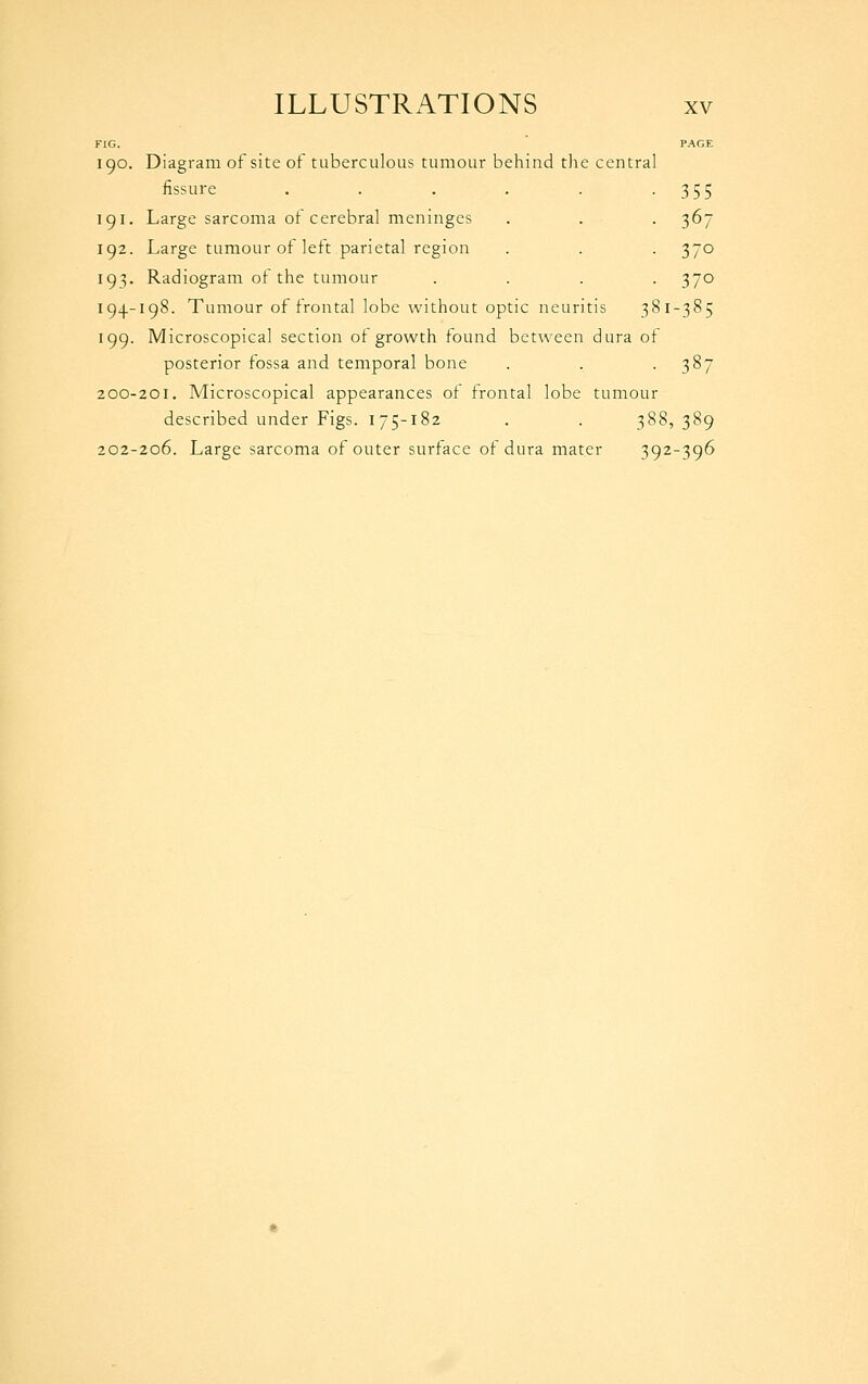 190. Diagram of site of tuberculous tumour behind tlie central fissure .... 355 367 370 370 191. Large sarcoma of cerebral meninges 192. Large tumour of left parietal region 19^. Radiogram of the tumour 194-198. Tumour of frontal lobe without optic neuritis 381-385 199. Microscopical section of growth found between dura of posterior fossa and temporal bone . . .387 200-201. Microscopical appearances of frontal lobe tumour described under Figs. 175-182 . . 388, 389 202-206. Large sarcoma of outer surface of dura mater 392-396