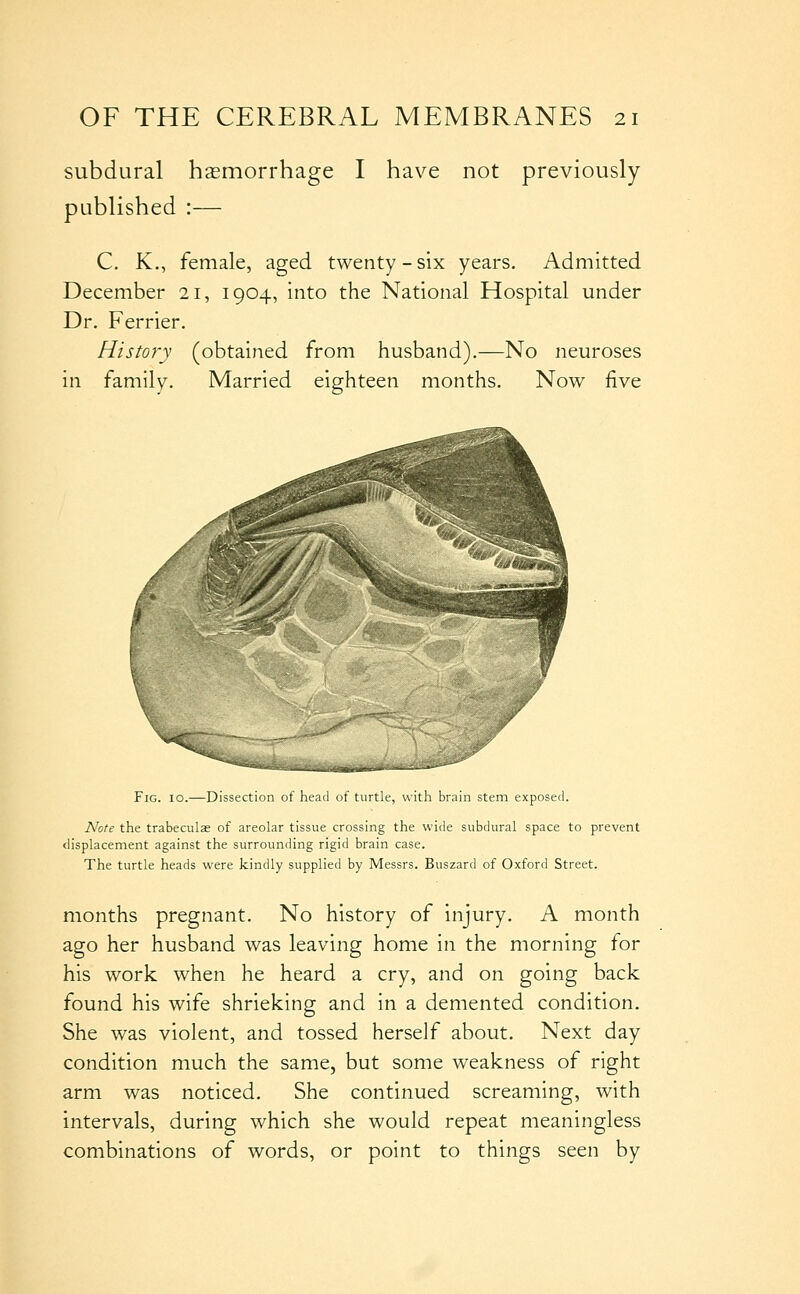 subdural hasmorrhage I have not previously published :— C. K., female, aged twenty-six years. Admitted December 21, 1904, into the National Hospital under Dr. Ferrier. History (obtained from husband).—No neuroses in family. Married eighteen months. Now five Fig. 10.—Dissection of head of turtle, with brain stem exposed. Note the trabecula of areolar tissue crossing the wide subdural space to prevent displacement against the surrounding rigid brain case. The turtle heads were kindly supplied by Messrs. Buszard of Oxford Street. months pregnant. No history of injury. A month ago her husband was leaving home in the morning for his work when he heard a cry, and on going back found his wife shrieking and in a demented condition. She was violent, and tossed herself about. Next day condition much the same, but some weakness of right arm was noticed. She continued screaming, with intervals, during which she would repeat meaningless combinations of words, or point to things seen by
