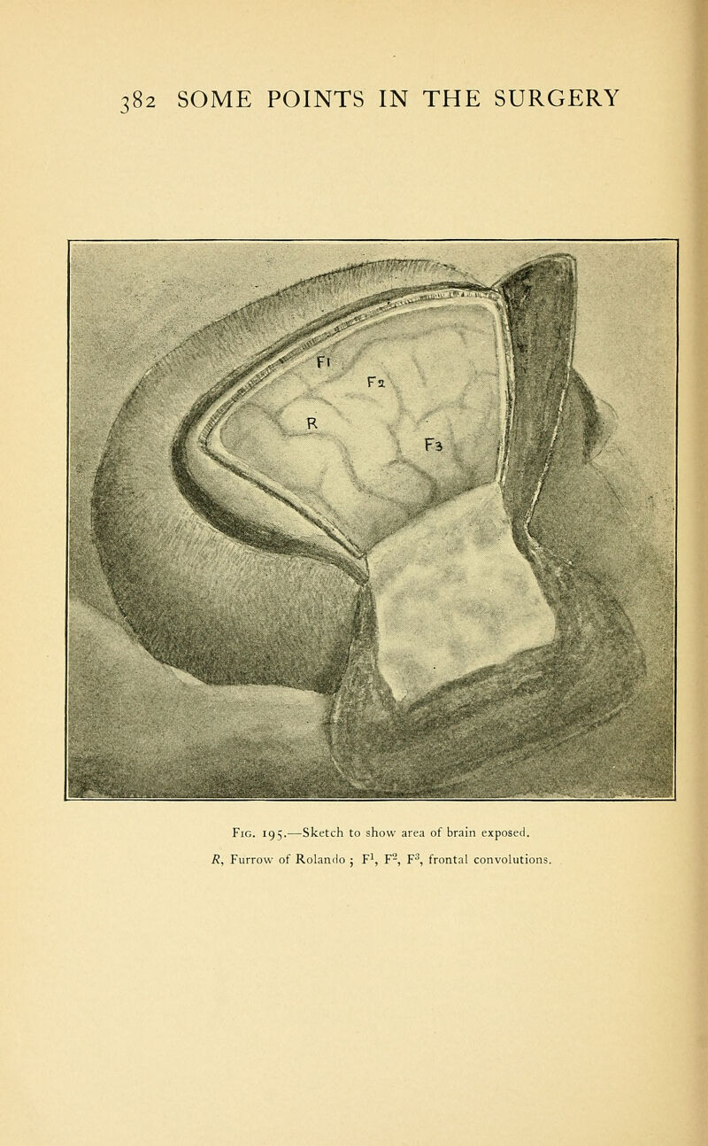 Fig. 195.—Sketch to show area of brain exf R, Furrow of Rolando ; F^, F^, F^, frontal convolutions.