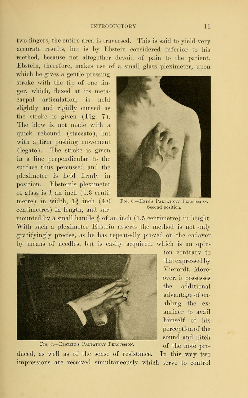two fingers, the entire area Is traversed. This is said to yield very accurate results, bu1 is by Ebstein considered inferior to his method, because uo1 altogether devoid of pain to the patient. Ebstein, therefore, makes use of a small glass pleximeter, upon which he gives a gentle pressing- stroke with the tip of one fin- ger, which, flexed at its meta- carpal articulation, is held slightly and rigidly curved as the stroke is given (Fig. 7). The blow is not made with a quick rebound (staccato), but with a firm pushing movement (legato). The stroke is given in a line perpendicular to the surface thus percussed and the pleximeter is held firmly in position. Ebstein's pleximeter of glass is -J an inch (1.3 centi- metre) in width, If inch (4.0 centimetres) in length, and sur- mounted by a small handle § of an inch (1.5 centimetre) in height. With such a pleximeter Ebstein asserts the method is not only gratifyingly precise, as he has repeatedly proved on the cadaver by means of needles, but is easily acquired, which is an opin- ion contrary to that expressed by Vierordt. More- over, it possesses the additional advantage of en- abling the ex- aminer to avail himself of his perception of the sound and pitch of the note pro- In this way two Fig. 6.—Hein's Palpatory Percussion. Second position. Fig. 7.—Ebstein's Palpatory Percussion. duced, as well as of the sense of resistance. impressions are received simultaneously which serve to control