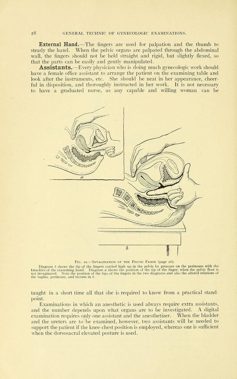 External Hand.—The fingers are used for palpation and the thumb to steady the hand. When the pelvic organs are palpated through the abdominal wall, the fingers should not be held straight and rigid, but slightly flexed, so that the parts can be easily and gently manipulated. Assistants.—Every physician who is doing much gynecologic work should have a female office assistant to arrange the patient on the examining table and look after the instruments, etc. She should be neat in her appearance, cheer- ful in disposition, and thoroughly instructed in her work. It is not necessary to have a graduated nurse, as any capable and willing woman can be Fig. 20.—Invagination of the Pelvic Floor (page 26). Diagram b shows the tip of the fingers carried high up in the pelvis by pressure on the perineum with the knuckles of the examining hand. Diagram a shows the position of the tip of the finger, when the pelvic floor is not invaginated. Note the position of the tips of the fingers in the two diagrams and also the altered relations of the vagina, perineum, and rectum in b. taught in a short time all that she is required to know from a practical stand- point. Examinations in which an anesthetic is used always require extra assistants, and the number depends upon what organs are to be investigated. A digital examination requires only one assistant and the anesthetizer. When the bladder and the ureters are to be examined, however, two assistants will be needed to support the patient if the knee-chest position is employed, whereas one is sufficient when the dorsosacral elevated posture is used.