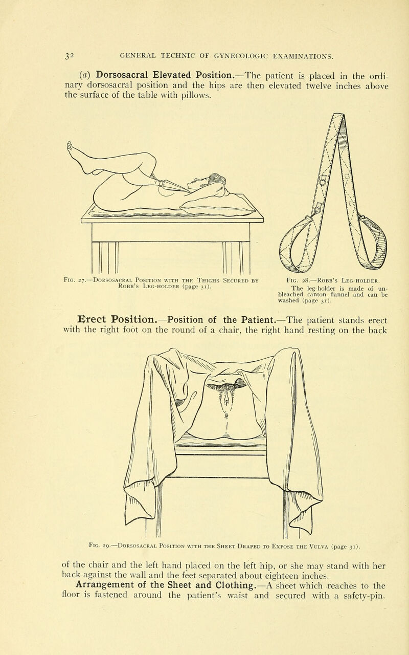 (a) Dorsosacral Elevated Position.—The patient is placed in the ordi- nary dorsosacral position and the hips are then elevated twelve inches above the surface of the table with pillows. Fig. 27.—Dorsosacral Position with the Thighs Secured by Robb's Leg-holder (page 31). Fig. 28.—Robb's Leg-holder. The leg-holder is made of un- bleached canton flannel and can be washed (page 31). Erect Position.—Position of the Patient.—The patient stands erect with the right foot on the round of a chair, the right hand resting on the back Fig. 29.—Dorsosacral Position with the Sheet Draped to Expose the Vulva (page 31). of the chair and the left hand placed on the left hip, or she may stand with her back against the wall and the feet separated about eighteen inches. Arrangement of the Sheet and Clothing.—A sheet which reaches to the floor is fastened around the patient's waist and secured with a safety-pin.