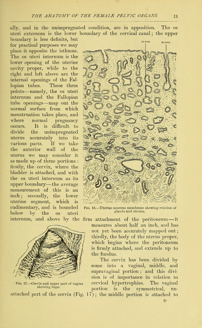 ally, and in the unimpregnated condition, are in apposition. The os uteri externum is the lower boundary of the cervical canal; the upper boundary is less definite, but for practical purposes we may place it opposite the isthmus. The os uteri internum is the lower opening of the uterine cavity proper, while to the right and left above are the internal openings of the Fal- lopian tubes. These three points—namely, the os uteri internum and the Fallopian tube openings—map out the normal surface from which menstruation takes place, and where normal pregnancy occurs. It is difficult to divide the unimpregnated uterus accurately into its various parts. If we take the anterior wall of the uterus we may consider it as made up of three portions : firstly, the cervix, where the bladder is attached, and with the os uteri internum as its upper boundary—the average measurement of this is an inch; secondly, the lower uterine segment, which is rudimentary, and is bounded below by the os uteri internum, and above by the firm attachment of the peritoneum—it measures about half an inch, and has not yet been accurately mapped out; thirdly, the body of the uterus proper, which begins where the peritoneum is firmly attached, and extends up to the fundus. The cervix has been divided by some into a vaginal, middle, and supravaginal portion; and this divi- sion is of importance in relation to cervical hypertrophies. The vaginal portion is the symmetrical, un- attached part of the cervix (Fig. 17); the middle portion is attached to D Fig. 16.—Uterine mucous membrane showing relation of glands and stroma. Fig. 17.- -Cervix and upper part of vagina showing rugse.