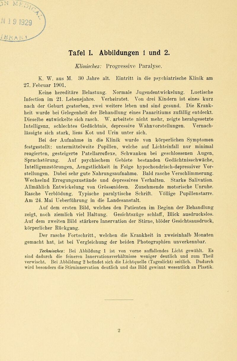 3N X ■N 1 9 1929 *) Tafel I. Abbildungen 1 und 2. Klinisches: Progressive Paralyse. K. W. aus M. 30 Jahre alt. Eintritt in die psychiatrische Klinik am 27. Februar 1901. Keine hereditäre Belastung. Normale Jugendentwickelung. Luetische Infection im 21. Lebensjahre. Verheiratet. Von drei Kindern ist eines kurz nach der Geburt gestorben, zwei weitere leben und sind gesund. Die Krank- heit wurde bei Gelegenheit der Behandlung eines Panaritiums zufällig entdeckt. Dieselbe entwickelte sich rasch. W. arbeitete nicht mehr, zeigte herabgesetzte Intelligenz, schlechtes Gedächtnis, depressive Wahnvorstellungen. Vernach- lässigte sich stark, Hess Kot und Urin unter sich. Bei der Aufnahme in die Klinik wurde von körperlichen Symptomen festgestellt: untermittel weite Pupillen, welche auf Lichteinfall nur minimal reagierten, gesteigerte Patellarreflexe, Schwanken bei geschlossenen Augen, Sprachstörung. Auf psychischem Gebiete bestanden Gedächtnisschwäche, Intelligenzstörungen, Aengstlicbkeit in Folge hypochondrisch-depressiver Vor- stellungen. Dabei sehr gute Nahrungsaufnahme. Bald rasche Verschlimmerung. Wechselnd Erregungszustände und depressives Verhalten. Starke Salivation. Allmählich Entwickelung von Grössenideen. Zunehmende motorische Unruhe. Rasche Verblödung. Typische paralytische Schrift. Völlige Pupillen starre. Am 24. Mai Ueberführung in die Landesanstalt. Auf dem ersten Bild, welches den Patienten im Beginn der Behandlung zeigt, noch ziemlich viel Haltung. Gesichtszüge schlaff, Blick ausdruckslos. Auf dem zweiten Bild stärkere Innervation der Stirne, blöder Gesichtsausdruck, körperlicher Rückgang. Der rasche Fortschritt, welchen die Krankheit in zweieinhalb Monaten gemacht hat. ist bei Vergleichung der beiden Photographien unverkennbar. Technisches: Bei Abbildung 1 ist von vorne auffallendes Licht gewählt. Es sind dadurch die feineren Innervationsverhältnisse weniger deutlich und zum Theil verwischt. Bei Abbildung 2 befindet sich die Lichtquelle (Tageslicht) seitlich. Dadurch wird besonders die Stirninnervation deutlich und das Bild gewinnt wesentlich an Plastik.