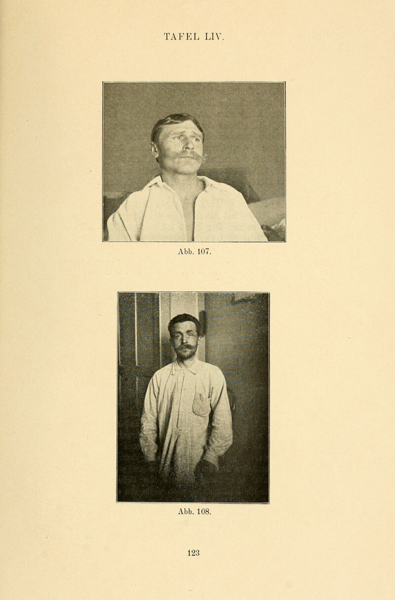 Abb. 107. , * y i  1 W i 1 i i 1 | / i\ ü) fiv u i KB ■•'...... ;;:^H ■t>'. In MB'' Jn Abb. 108.