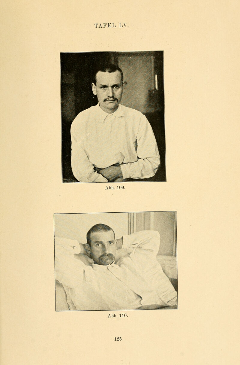 Abb. 109. Abb. 110.