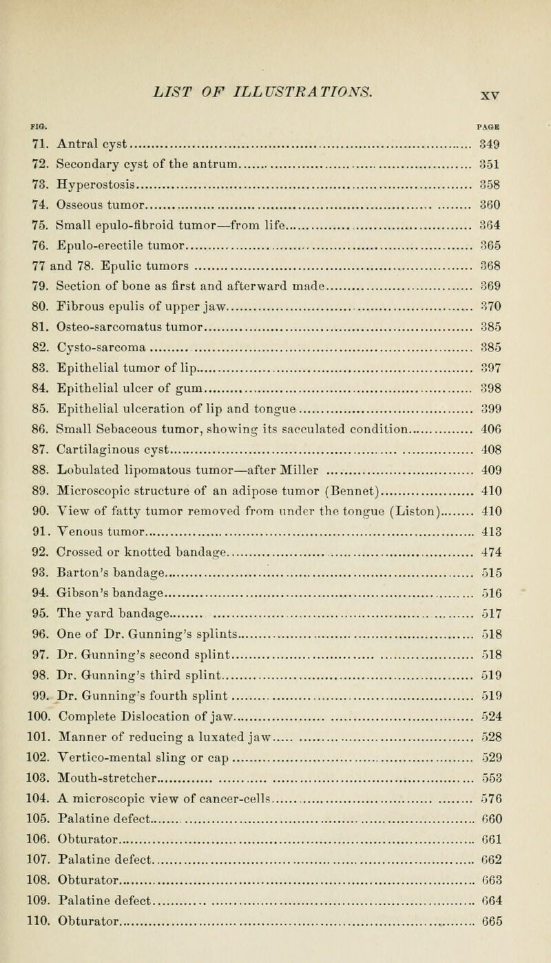FIO. PAGH 71. Antral cyst 349 72. Secondary cyst of the antrum 351 73. Hyperostosis 358 74. Osseous tumor 360 75. Small epulo-fibroid tumor—from life 364 76. Epulo-erectile tumor 365 77 and 78. Epulic tumors 368 79. Section of bone as first and afterward made 369 80. Fibrous epulis of upper jaw 370 81. Osteo-sarcoraatus tumor 385 82. Cysto-sarcoma 385 88. Epithelial tumor of lip .397 84. Epithelial ulcer of gum 398 85. Epithelial ulceration of lip and tongue 399 86. Small Sebaceous tumor, showing its sacculated condition 406 87. Cartilaginous cyst 408 88. Lobulated lipomatous tumor—after Miller 409 89. Microscopic structure of an adipose tumor (Bennet) 410 90. View of fatty tumor removed from under the tongue (Listen) 410 91. Venous tumor 413 92. Crossed or knotted bandage 474 93. Barton's bandage 515 94. Gibson's bandage 516 95. The yard bandage 517 96. One of Dr. Gunning's splints 518 97. Dr. Gunning's second splint 518 98. Dr. Gunning's third splint 519 99. Dr. Gunning's fourth splint 519 100. Complete Dislocation of jaw 524 101. Manner of reducing a luxated jaw 528 102. Vertico-mental sling or cap 529 103. Mouth-stretcher 553 104. A microscopic view of cancer-cells 576 105. Palatine defect 660 106. Obturator 661 107. Palatine defect G62 108. Obturator 663 109. Palatine defect 664 110. Obturator 665