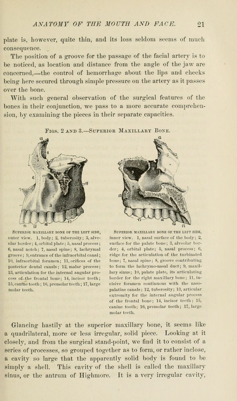 plate is, however, quite thin, and its loss seldom seems of much consequence. The position of a groove for the passage of the facial artery is to be noticed, as location and distance from the angle of the jaw are concerned,—the control of hemorrhage about the lips and cheeks being here secured through simple pressure on the artery as it passes over the bone. With such general observation of the surgical features of the bones in their conjunction, we pass to a more accurate comprehen- sion, by examining the pieces in their separate capacities. Pigs. 2 and 3.—Superior Maxillary Bone. Superior maxulart bone of the left side, outer view. 1, body; 2, tuberosity; 3, alve- olar border; 4, orbital plate; 5, nasal process ; 6, nasal notch; 7, nasal spine; 8, lachrymal groove ; 9, entrance of the infraorbital canal; 10, infraorbital foramen; 11, orifices of the posterior dental canals ; 12, malar process; 13, articulation for the internal angular pio- cess of the frontal bone; 14, incisor teeth; 15, canine tooth; 16, premolar teeth; 17, large molar teeth. Superior maxillary bone of the left side, inner view. 1, nasal surface of the body; 2, surface for the palate bone; 3, alveolar bor- der ; 4, orbital plate; 5, nasal process; 6, ridge for the articulation of the turbinated bone; 7, nasal spine; 8, groove contributing to form the lachrymo-nasal duct; 9, maxil- lary sinus; 10, palate plate, its articulating border for the right maxillary bone; 11, in- cisive foramen continuous with the naso- palatine canals; 12, tuberosity; LS, articular extremity for the internal angular process of the frontal bone; 14, incisor teeth; 15, canine tooth; 16, premolar teeth; 17, large molar teeth. Glancing hastily at the superior maxillary bone, it seems like a quadrilateral, moi'e or less irregular, solid piece. Looking at it closelv, and from the surgical stand-point, we find it to consist of a series of processes, so grouped together as to form, or rather inclose, a cavity so large that the apparently solid body is found to be simply a shell. This cavity of the shell is called the maxillary sinus, or the antrum of Highmore. It is a very irregular cavity.