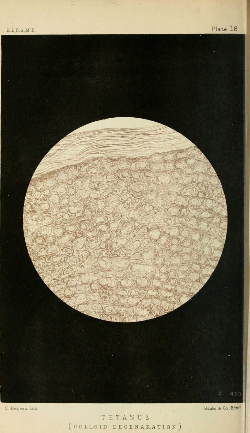 C Berjeau.Lith. T E T A I^I U S (colloid d e ge t^ a rat I 0 n )