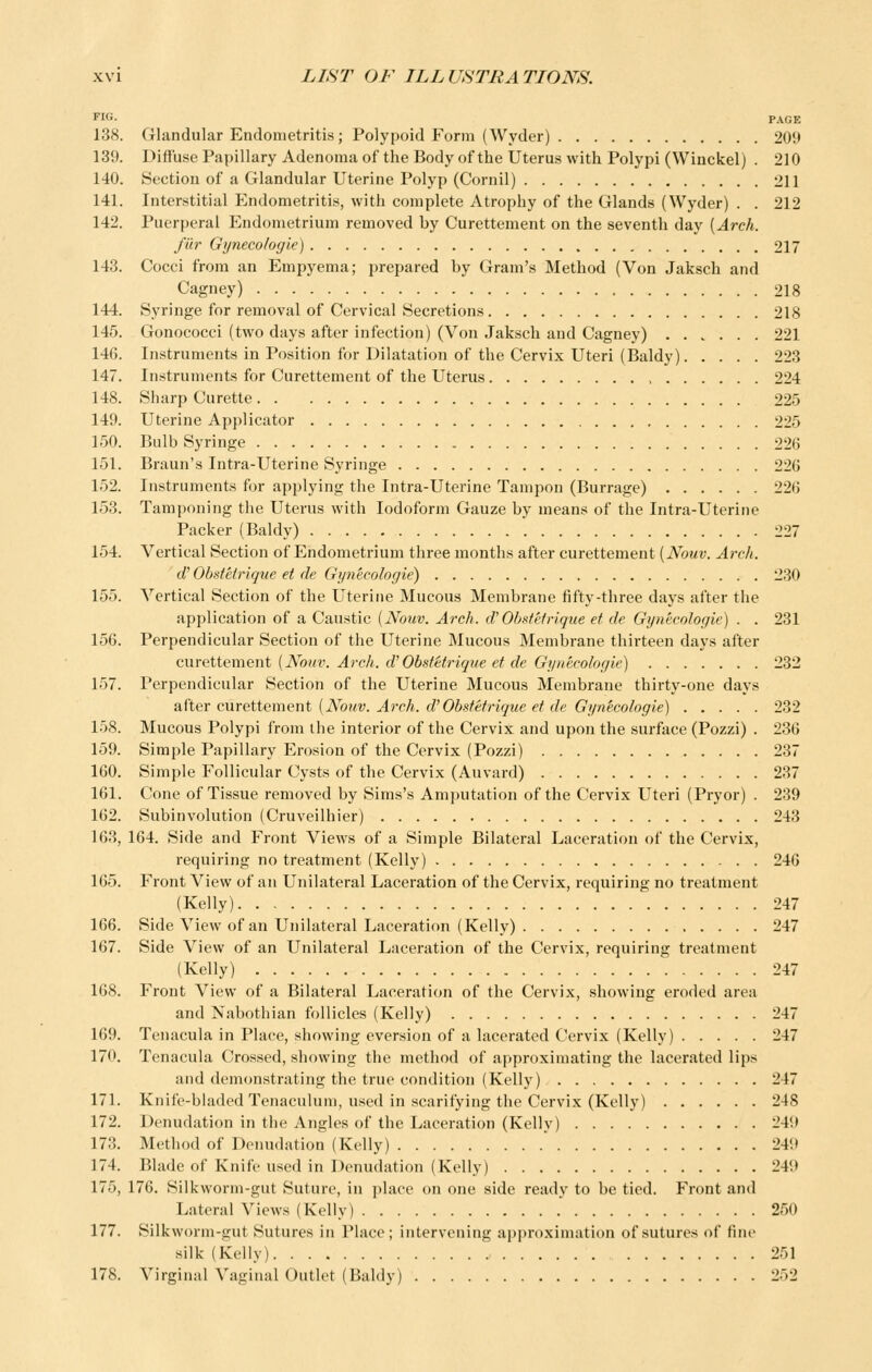 Flfi- PAGE 138. Glandular Endometritis; Polypoid Form (Wyder) 209 139. Diffuse Papillary Adenoma of the Body of the Uterus with Polypi (Winckel) . 210 140. Section of a Glandular Uterine Polyp (Cornil) 211 141. Interstitial Endometritis, with complete Atrophy of the Glands (Wyder) . . 212 142. Puerperal Endometrium removed by Curettement on the seventh day [Arch. fur Gijnecologie) 217 143. Cocci from an Empyema; prepared by Gram's Method (Von Jaksch and Cagney) 218 144. Syringe for removal of Cervical Secretions 218 145. Gonococci (two days after infection) (Von Jaksch and Cagney) 221 146. Instruments in Position for Dilatation of the Cervix Uteri (Baldy) 223 147. Instruments for Curettement of the Uterus 224 148. Sharp Curette 225 149. Uterine Applicator 225 150. Bulb Syringe 226 151. Braun's Intra-Uterine Syringe 226 152. Instruments for applying the Intra-Uterine Tampon (Burrage) 226 153. Tamponing the Uterus with Iodoform Gauze by means of the Intra-Uterine Packer (Baldy) 227 154. Vertical Section of Endometrium three months after curettement [Nouv. Arch. df Obstelrique et de Gijnecologie) 230 155. Vertical Section of the Uterine Mucous Membrane fifty-three days after the application of a Caustic [Nouv. Arch. cVObsielrique et de Gynecologic) . . 231 156. Perpendicular Section of the Uterine Mucous Membrane thirteen days after curettement [Noiiv. Arch. d'Obsfetrique et de Gynecologic) 232 157. Perpendicular Section of the Uterine Mucous Membrane thirty-one days after curettement [Noriv. Arch. d'Obsfefrique et de Gynecologic) 232 158. Mucous Polypi from the interior of the Cervix and upon the surface (Pozzi) . 236 159. Simple Papillary Erosion of the Cervix (Pozzi) 237 160. Simple Follicular Cysts of the Cervix (Auvard) 237 161. Cone of Tissue removed by Sims's Amputation of the Cervix Uteri (Pryor) . 239 162. Subinvolution (Cruveilhier) 243 163. 164. Side and Front Views of a Simple Bilateral Laceration of the Cervix, requiring no treatment (Kelly) 246 165. Front View of an Unilateral Laceration of the Cervix, requiring no treatment (Kelly) 247 166. Side View of an Unilateral Laceration (Kelly) 247 167. Side View of an Unilateral Laceration of the Cervix, requiring treatment (Kelly) 247 168. Front View of a Bilateral Laceration of the Cervix, showing eroded area and Nabothian follicles (Kelly) 247 169. Tenacula in Place, showing eversion of a lacerated Cervix (Kelly) 247 170. Tenacula Crossed, showing the method of approximating the lacerated lips and demonstrating the true condition (Kelly) 247 171. Knife-bladed Tenaculum, used in scarifying the Cervix (Kelly) 248 172. Denudation in the Angles of the Laceration (Kelly) 24i» 173. Method of Denudation (Kelly) * 249 174. Blade of Knife used in Denudation (Kelly) 249 175. 176. Silkworm-gut Suture, in place on one side ready to be tied. Front and Lateral Views (Kelly) .' 250 177. Silkworm-gut Sutures in Place; intervening ai)proximation of sutures of fine silk (Kelly) 251 178. Virginal Vaginal Outlet (Baldy) 252