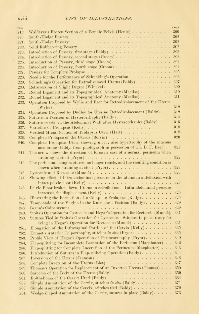 FIG. PAGE 219. Waldeyer's Frozen Section of a Female Pelvis (Henle) 300 220. Smith-Hodge Pessary 302 221. Smith-Hodge Pessary 302 222. Solid Rubber-ring Pessary 302 223. Introduction of Pessary, first stage (Baldy) 303 224. Introduction of Pessary, second stage (Groom) 303 225. Introduction of Pessary, third stage (Groom) 304 226. Introduction of Pessary, fourth stage (Groom) 304 227. Pessary for Gomplete Prolapse 305 228. Needle for the Performance of Schucking's Operation 306 229. Schucking's Operation for Retrodisplaced Uterus (Baldy) 307 230. Retroversion of Slight Degree (Winckel) 309 231. Round Ligament and its Topographical Anatomy (Maclise) 310 232. Round Ligament and its Topographical Anatomy (Maclise) 311 233. Operation Proposed by Wylie and Baer for Retrodisplacement of the Uterus (Wylie) 312 234. Operation Proposed by Dudley for Uterine Retrodisplacement (Baldy) . . . 312 235. Sutures in Position in Hysterorrhaphy (Baldy) 314 236. Sutures in situ in the Abdominal Wall after Hysterorrhaphy (Baldy) . . . 315 237. Varieties of Prolapsus (Kelly) 318 238. Vertical Mesial Section of Prolapsus Uteri (Hart) 319 239. Gomplete Prolapse of the Uterus (Boivin) 320 240. Gomplete Prolapsus Uteri, showing ulcer; also hypertrophy of the mucous membrane (Baldy, from photograph in possession of Dr. B. F. Baer) . . 321 241. The arrow shows the direction of force in case of a normal perineum when straining at stool (Pryor) 322 242. The perineum, being ruptured, no longer resists, and the resulting condition is shown when straining at stool (Pryor) 323 243. Gystocele and Rectocele (Munde) 323 244. Showing effect of intra-abdominal pressure on the uterus in anteflexion with intact pelvic floor (Kelly) 325 245. Pelvic Floor broken down, Uterus in retroflexion. Intra-abdominal pressure increases the displacement (Kelly) 325 246. Illustrating the Formation of a Gomplete Prolapsus (Kelly) 325 247. Tamponade of the Vagina in the Knee-chest Position (Baldy) 329 248. Braun's Golpeurynter 329 249. Stoltz's Operation for Gystocele and Hegar's Operation for Rectocele (Mund6). 331 250. Sutures Tied in Stoltz's Operation for Gystocele. Stitches in place ready for tying in Hegar's Operation for Rectocele (Mund6) 331 251. Elongation of the Infravaginal Portion of the Gervix (Kelly) 335 252. Emmet's Anterior Golporrhaphy, stitches in situ (Pryor) 335 253. Profile View of Hegar's Operation of Perineorrhaphy (Pryor) 340 254. Flap-splitting for Incomplete Laceration of the Perineum (Macphatter) . . 342 255. Flap-splitting for Gomplete Laceration of the Perineum (Macphatter) . . . 343 256. Introduction of Sutures in Flap-splitting Operation (Baldy) 344 257. Inversion of the Uterus (Jean^on) 346 258. Gomplete Inversion of the Uterus (Biot) 347 259. Thomas's Operation for Replacement of an Inverted Uterus (Thomas) . . . 350 260. Sarcoma of the Body of the Uterus (Baldy) 359 261. Epitheliomaof the Gervix Uteri (Baldy) 364 262. Simple Amputation of the Gervix, stitches/« sjVm (Baldy) 371 263. Simple Amjmtation of the Gervix, stitches tied (Baldy) 372 264. Wedge-shaped Amputation of the Gervix, sutures in place (Baldy) 373