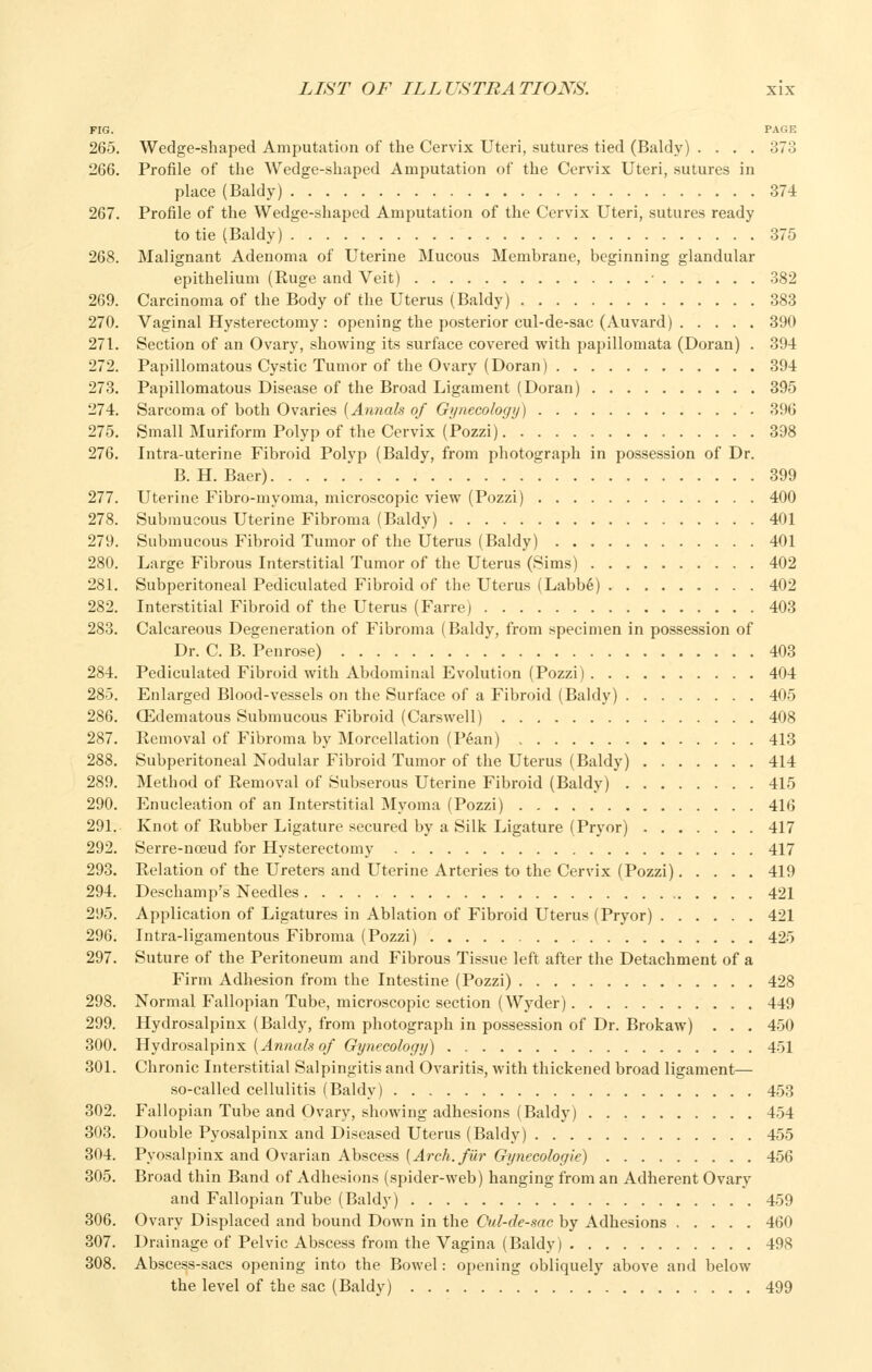 FIG. PAGE 265. Wedge-shaped Amputation of the Cervix Uteri, sutures tied (Baldy) .... 373 266. Profile of the Wedge-shaped Amputation of the Cervix Uteri, sutures in place (Baldy) 374 267. Profile of the Wedge-shaped Amputation of the Cervix Uteri, sutures ready to tie (Baldy) 375 268. Malignant Adenoma of Uterine Mucous Membrane, beginning glandular epithelium (Ruge and Veit) • 382 269. Carcinoma of the Body of the Uterus (Baldy) 383 270. Vaginal Hysterectomy : opening the posterior cul-de-sac (Auvard) 390 271. Section of an Ovary, showing its surface covered with papillomata (Doran) . 394 272. Papillomatous Cystic Tumor of the Ovary (Doran) 394 273. Papillomatous Disease of the Broad Ligament (Doran) 395 274. Sarcoma of both Ovaries (Annals of Gi/necologii) 396 275. Small Muriform Polyp of the Cervix (Pozzi) 398 276. Intra-uterine Fibroid Polyp (Baldy, from photograph in possession of Dr. B. H. Baer)  399 277. Uterine Fibro-myoma, microscopic view (Pozzi) 400 278. Submucous Uterine Fibroma (Baldy) 401 279. Submucous Fibroid Tumor of the Uterus (Baldy) 401 280. Large Fibrous Interstitial Tumor of the Uterus (Sims) 402 281. Subperitoneal Pediculated Fibroid of the Uterus (Labbe) 402 282. Interstitial Fibroid of the Uterus (Farre) 403 283. Calcareous Degeneration of Fibroma (Baldy, from specimen in possession of Dr. C. B. Penrose) 403 284. Pediculated Fibroid with Abdominal Evolution (Pozzi) 404 285. Enlarged Blood-vessels on the Surface of a Fibroid (Baldy) 405 286. CEdematous Submucous Fibroid (Carswell) 408 287. Eemoval of Fibroma by Morcellation (Pean) 413 288. Subperitoneal Nodular Fibroid Tumor of the Uterus (Baldy) 414 289. Method of Removal of Subserous Uterine Fibroid (Baldy) 415 290. Enucleation of an Interstitial Myoma (Pozzi) 416 291. Knot of Rubber Ligature secured by a Silk Ligature (Pryor) 417 292. Serre-noeud for Hysterectomy 417 293. Relation of the Ureters and Uterine Arteries to the Cervix (Pozzi) 419 294. Deschamp's Needles 421 295. Application of Ligatures in Ablation of Fibroid Uterus (Pryor) 421 296. Intra-ligamentous Fibroma (Pozzi) 425 297. Suture of the Peritoneum and Fibrous Tissue left after the Detachment of a Firm Adhesion from the Intestine (Pozzi) 428 298. Normal Fallopian Tube, microscopic section (Wyder) 449 299. Hydrosalpinx (Baldy, from photograph in possession of Dr. Brokaw) . . . 450 300. Hydrosalpinx [Annals of Gynecology) . , 451 301. Chronic Interstitial Salpingitis and Ovaritis, with thickened broad ligament— so-called cellulitis (Baldy) 453 302. Fallopian Tube and Ovary, showing adhesions (Baldy) 454 303. Double Pyosalpinx and Diseased Uterus (Baldy) 455 304. Pyosalpinx and Ovarian Abscess {Arch, fur Gynecologie) 456 305. Broad thin Band of Adhesions (spider-web) hanging from an Adherent Ovary and Fallopian Tube (Baldy) 459 306. Ovary Displaced and bound Down in the Cul-de-sac by Adhesions 460 307. Drainage of Pelvic Abscess from the Vagina (Baldy) 498 308. Abscess-sacs opening into the Bowel: opening obliquely above and below the level of the sac (Baldy) 499