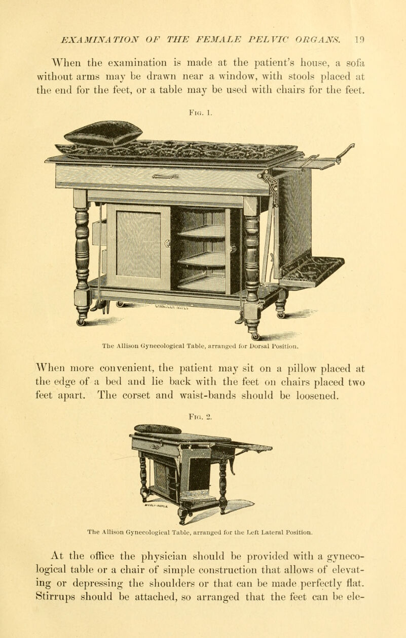 When the examination is made at the patient's house, a sofe without arms may be drawn near a window, with stools placed at the end for the feet, or a table may be used with chairs for the feet. P^Ki. 1. The Allison Gynecological Table arringtd lor Dorsal Position When more convenient, the patient may sit on a pillow placed at the edge of a bed and lie back with the feet on chairs placed two feet apart. The corset and waist-bands should be loosened. Fir:. 2. The Allison Gynecological Table, arranged for the Left Lateral Position. At the office the physician should be provided with a gyneco- logical table or a chair of simple construction that allows of elevat- ing or depressing the shoulders or that can be made perfectly flat. Stirrups should be attached, so arranged that the feet can be ele-