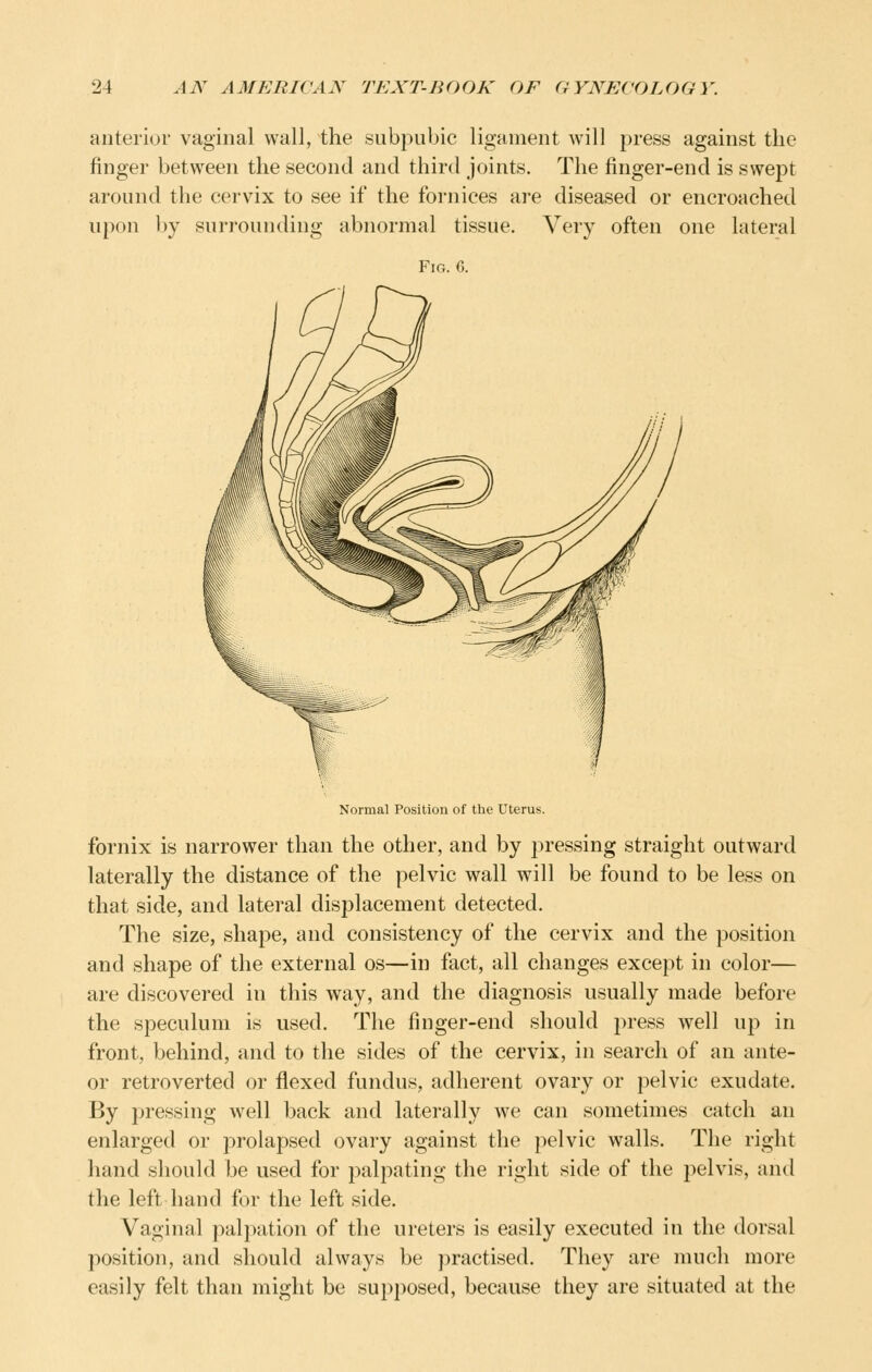 anterior vaginal wall, the subpubic ligament will press against the finger between the second and third joints. The finger-end is swejDt around the cervix to see if the fornices are diseased or encroached upon by surrounding abnormal tissue. Very often one lateral Fig. 6. Normal Position of the Uterus. fornix is narrower than the other, and by pressing straight outward laterally the distance of the pelvic wall will be found to be less on that side, and lateral displacement detected. The size, shape, and consistency of the cervix and the position and shape of the external os—in fact, all changes except in color— are discovered in this way, and the diagnosis usually made before the speculum is used. The finger-end should press well up in front, behind, and to the sides of the cervix, in search of an ante- or retroverted or flexed fundus, adherent ovary or pelvic exudate. By pressing well back and laterally we can sometimes catch an enlarged or prolapsed ovary against the pelvic walls. The right hand should he used for palpating the right side of the pelvis, and the left hand for the left side. Vaginal palpation of the ureters is easily executed in the dorsal position, and should always be practised. They are much more easily felt than might be supposed, because they are situated at the