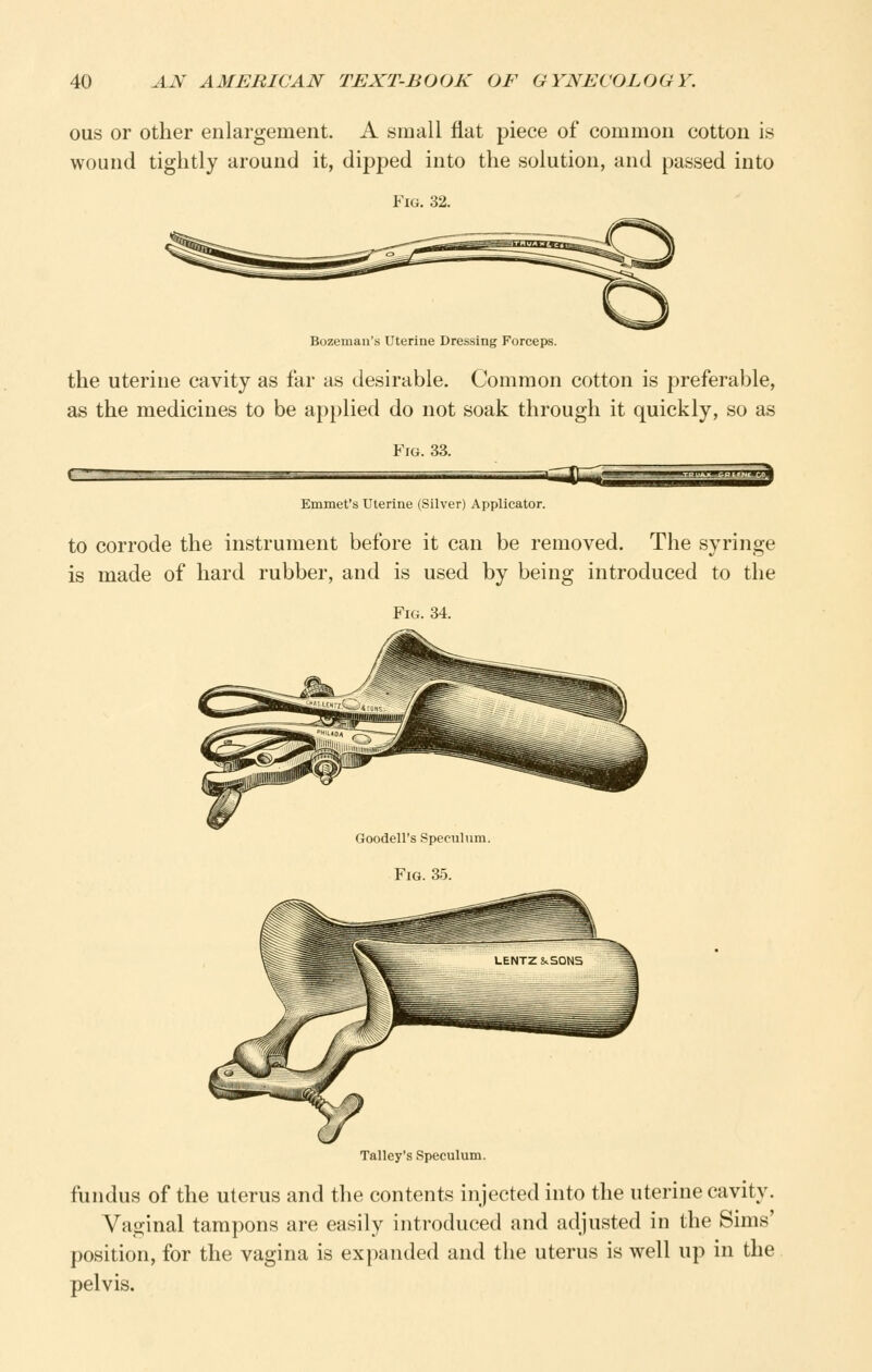 ous or other enlargement. A small fiat piece of common cotton is wound tightly around it, dipped into the solution, and passed into Fig. 32. Bozemaii's Uterine Dressing Forceps. the uterine cavity as far as desirable. Common cotton is preferable, as the medicines to be applied do not soak through it quickly, so as Fig. 33. Emmet's Uterine (Silver) Applicator. to corrode the instrument before it can be removed. The syringe is made of hard rubber, and is used by being introduced to the Fig. 34. Goodell's Speculum. Fig. 35. Talley's Speculum. fundus of the uterus and the contents injected into the uterine cavity. Vaginal tampons are easily introduced and adjusted in the Sims' position, for the vagina is expanded and the uterus is well up in the pelvis.